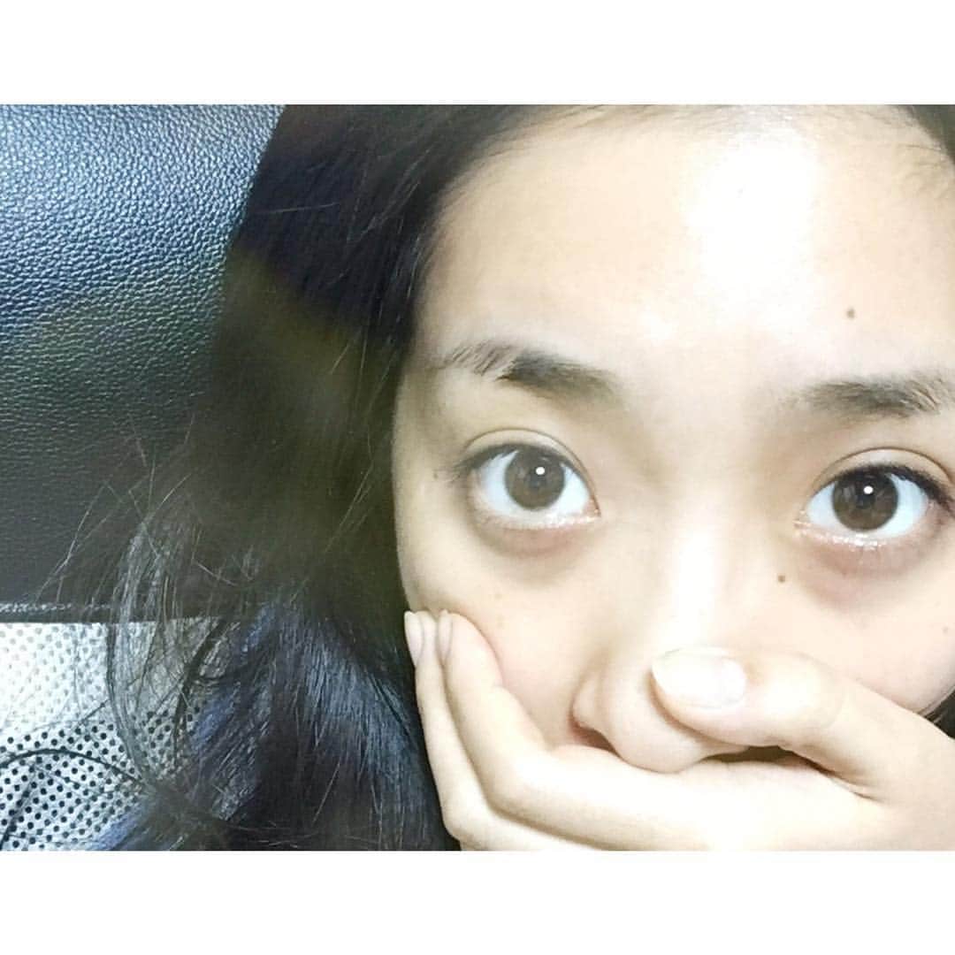 Choicerishのインスタグラム：「あれ 昨日出来たはずのおでこのでっかいニキビが消えとる。 やっぱり睡眠って大事なんだね…！ みなさん、ニキビができたら16時間寝ましょう‼︎‼︎ #ニキビ #ニキビケア #肌荒れ #chihiro #choicerish #youtuber」
