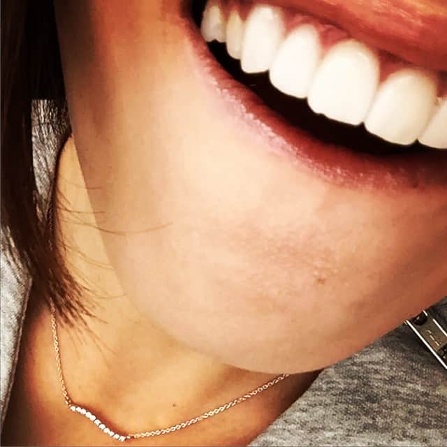 小森純さんのインスタグラム写真 - (小森純Instagram)「右の前歯。  かけた。  #歯#かけた#歯医者#ショック#助けて#ムリ」4月13日 12時22分 - jun.komori1122
