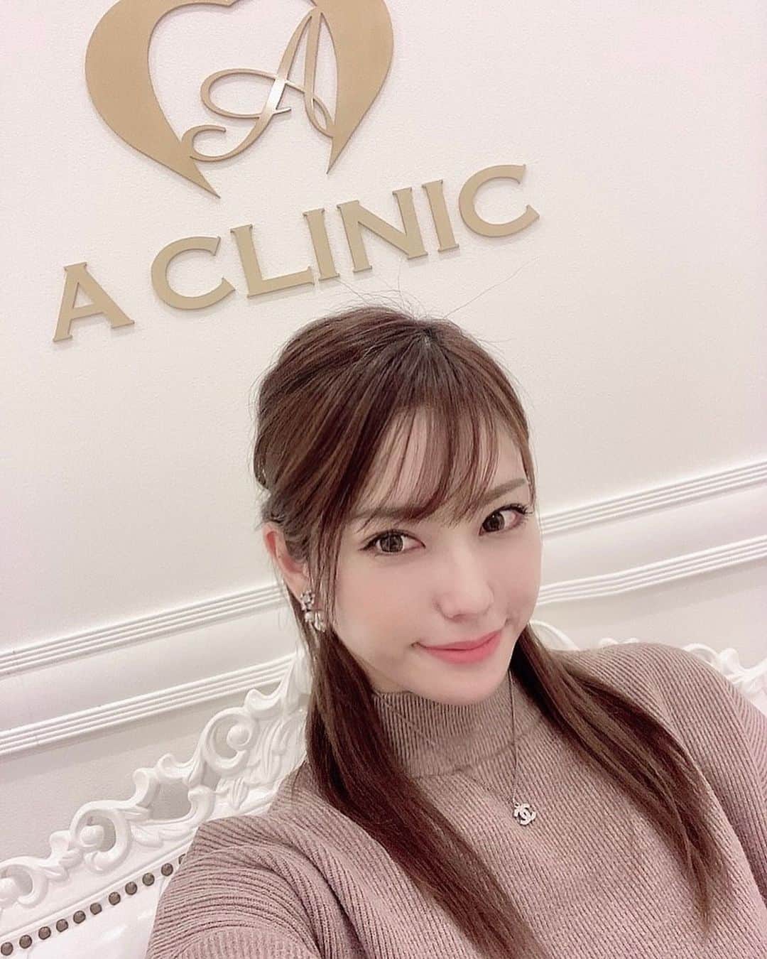 星野奏さんのインスタグラム写真 - (星野奏Instagram)「⁡ ⁡  #aclinicデンタル の永江先生 @aclinic_nagae に“スマイルリップ”を施術して頂きました✨ ⁡ 唇の厚みの左右差が気になっていたのですが。。。 バランスを整えて頂き、さらに口角も上がりプルプルです👄 ⁡ 施術中も少しずつ鏡で確認しながら行ってくださり安心でした♪ 最初は、針が痛そうだなぁと思っていましたがこれが！！全く痛くなくあっという間に完了してびっくりです〜✨ ⁡ 私は歯科衛生士ということもあり 口や歯に関してはこだわりがかなり強いのですが大満足です💕 ⁡ 他には#aclinicデンタルで人気の、ほうれい線に良いとされるグロースファクターというのが気になってます☺️ ⁡ ⁡ @a_clinic_dental @aclinic_nagae ⁡ #スマイルリップ #aclinic #aクリニック #エークリニック #aclinicデンタル #aclinicdental #デンタルクリニック #審美歯科 #矯正歯科 #リップヒアル #唇ヒアルロン酸 #口角ボトックス #M字リップ #Cカールリップ #アヒル口 #リップ #リップグロス #ラシャスリップス #歯科医師  #セラミック永江 #永江章人」2月20日 13時38分 - hoshino_kanade_