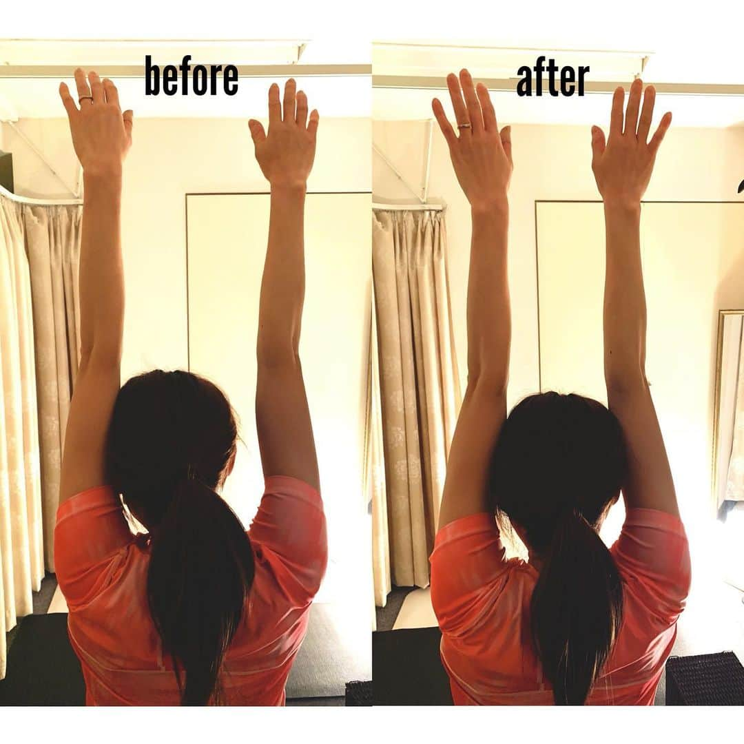 浅田梨奈さんのインスタグラム写真 - (浅田梨奈Instagram)「before→after😂😂😂 久々に行ってきました🤸‍♀️🧘‍♀️ バキバキやったぁー😅😅😅 NATSUKIトレーナー(@natsuki56612 ) ありがとうございます🙇‍♀️  至って真剣にバンザイしてるし🙌 真剣に脇腹伸ばそうとしてるよ🙌  回復が早くなったり疲労感が軽減したところもあったけど 違和感があるところのbefore→afterは え？😳 ん？😳 って2人で笑っていました😂  特に背中や首はセルフケアでは十分では無いので しっかりほぐしてもらいました🤗  ラクになったぁー😇  @team_liprond  #ボウリング #bowling #プロボウラー #女子アスリート #浅田梨奈 #スターレーン #liprond #teamliprond #NATSUKIトレーナー #b3 #脳科学ストレッチ #メンテナンス #コンディショニング #ストレッチ女子 #疲労と筋肉痛が相まって #不思議な動きしてる #ラクにしてもらったよ #ありがとうございます」2月28日 10時34分 - asdrn528