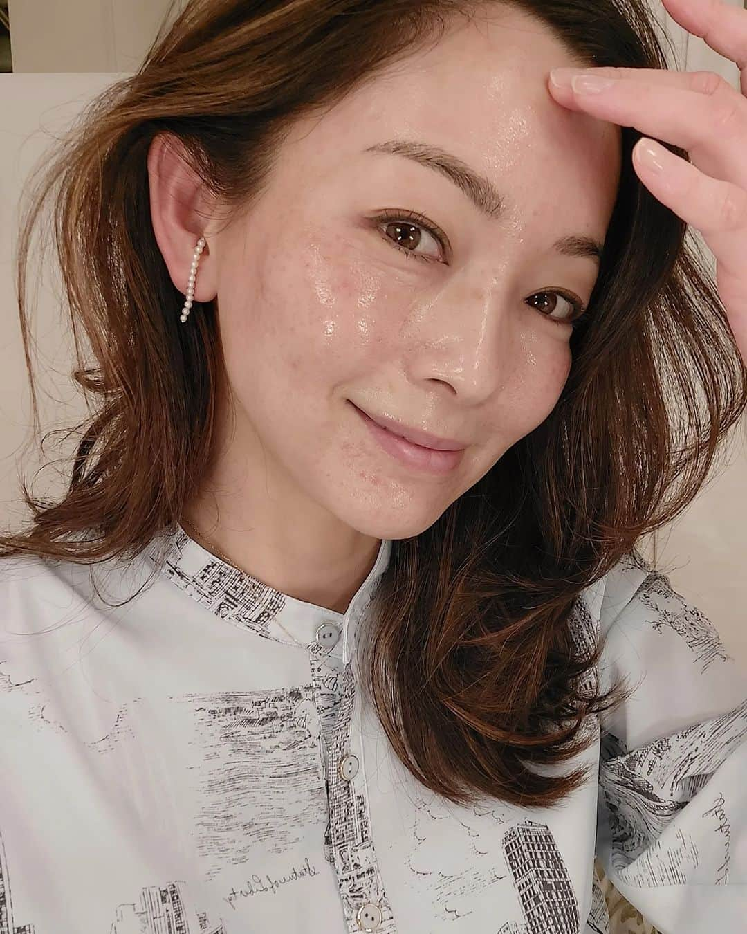 佐藤純さんのインスタグラム写真 - (佐藤純Instagram)「CHRISTINA CLINIC GINZA でお肌のメンテナンス✨  @christinaginza   水光注射してきたよ💉  水光注射は、ヘッドに9針ついていて、一度に細かく注射することで、肌の水分補給やくすみの解消、弾力性の向上、シワや小ジワに効くの。  麻酔もしてくれるのでそんなに痛みはないよ😉  3枚目、4枚目は施術直後。  針穴がいっぱいで衝撃的な写真だけど載せちゃう😁  施術直後から、艶がでてるのがわかる‼️  この針穴の傷は、その日のうちにひくよ～😊  肌がキレイになると気分も上がるよね⤴️  #christinaginza #christinaclinicginza #クリスティーナクリニック銀座 #水光注射 #アンチエイジング #美容 #シワ #くすみ #はり #ママ #ママモデル #モデル #mama #mamamodel #model」3月25日 20時32分 - junsatoidea