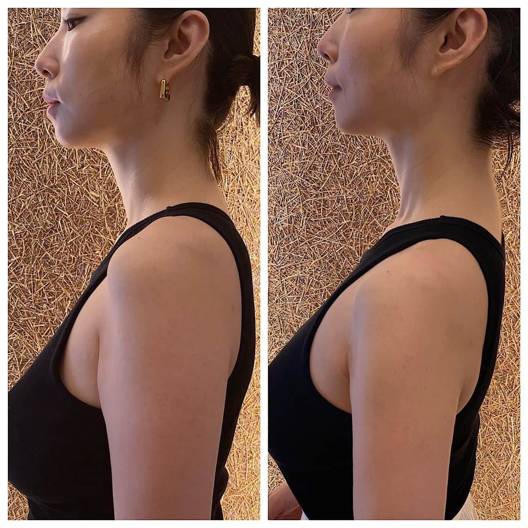 MEGUMIさんのインスタグラム写真 - (MEGUMIInstagram)「私の美容の情報源の1人であるおぐねぇーさん。  本当に不思議な程、世界中の美容情報は姉さんの元に集まります🧐  そんなおぐねぇーが、 ありとあらゆる物を試した中で、これだ！！と感激し、 何とお店まで出したという事で行ってきました。  リリースカッターという物で、 電気が流れた特殊な手袋で全身をマッサージしてくれ、筋膜を剥がしてくれる物です。  こり、浮腫みを流して、更に引き上げてくれるという凄い物でした！  ３枚目の写真ヤバくないですか？ 一回で首が細く長くなって、二の腕も細くなりました😳  35才過ぎたら、この辺りの浮腫みが貫禄を生みますよね😅 貫禄とか本当いらないです🙅‍♀️🤣  顔もお尻も足も胸もメチャクチャ締まって上がります！ 本当におススメ🙋‍♀️  皆さま是非行ってみてねー！ #MEGUMの美容日記 #美容は必ず変わるからお互い頑張ろー！  Mr. Oguna is one of my sources of beauty information. The beauty information from all over the world is gathered with your sister🧐 I don't think so. "After trying everything, I was so impressed that I went to the restaurant." It is a release cutter that massages the whole body and removes the fascia with special gloves with electric current flowing through it. This was really amazing, and it made me feel swollen and swollen, and it was amazing!! Isn't the third photo crazy? My neck became thinner and longer at once, and my arms became thinner😳 If you're over 35 years old, the swelling around here will create dignity 😅 Your face, hips, and legs are tight and you go up! Highly recommended🙋♀️ Everyone, be sure to go there! @kenichi_ogura @salondesmilon」5月2日 13時15分 - megumi1818