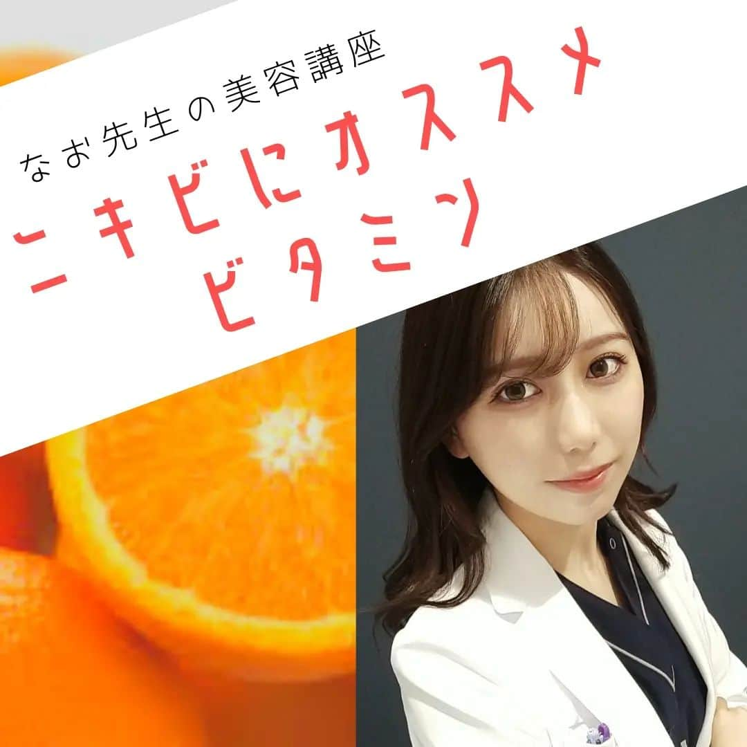 NAOさんのインスタグラム写真 - (NAOInstagram)「本日はニキビにオススメなビタミンについてお話します🍊 ニキビが出来た時の対症療法も大切ですが、理想としてはニキビの出来づらいお肌になりたいですよね✨  ニキビ改善セットとして ☆シナール(ビタミンC) ☆ユベラ(ビタミンE) ☆ハイボン(ビタミンB2) ☆ピドキサール(ビタミンB6) の内服セットもご用意しております。 外からだけでなく内側からも改善していきましょう！  おまけとしてニキビとチョコレートの関係についてもお話してます🍫  #ビタミンc #ビタミンe #ビタミンb2 #ビタミンb6 #ビタミンb #ニキビケア #ニキビ #ニキビ改善 #にきび #美肌ケア #美肌 #きれいになりたい #シナール #チョコレート #美容オタク #美容医療 #美容皮膚科医 #美容女医 #美容垢 #美容マニア #肌荒れ #肌荒れケア #肌荒れ改善 #綺麗になりたい人集まれ #女医stagram #なお先生」5月16日 19時00分 - dr_nao_0415