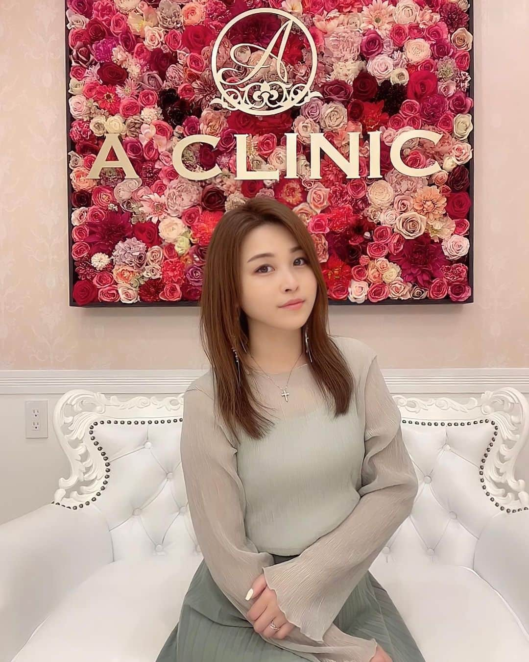 mikaさんのインスタグラム写真 - (mikaInstagram)「♥︎︎∗︎*ﾟ @aclinic_shinjuku で木家先生 @aclinic_kiya に “1day小顔脂肪吸引”の施術をしてもらって数日✨ ． まだダウンタイム中なハズのにすでに気になってたたるみや フェイスラインがスッキリしてて嬉しい💕 ． 凄い痛くて腫れるってイメージだったけど 心配だった痛みもなく腫れもほぼゼロ！ 多少のアザはメイクで隠れる程度だから問題なし🙆‍♀️ ． ． 友達にも痩せた？って言われて、喜んでる🙌 顔の悩みが解消されると綺麗でいようってモチベが爆上がりしてるよ💖 思っていたよりお手軽にできたので、 顔のお肉やたるみが気になってる人にお勧めします！ 目の下のふくらみとりとか気になるな♬ ． ． ． ． #aclinic #aクリニック #エークリニック #aclinic銀座 #aclinic横浜 #aclinic新宿 #美容外科 #美容皮膚科  #1day小顔脂肪吸引 #1day小顔 #脂肪吸引 #小顔 #美肌 #二重あご #フェイスライン  #糸リフト #aスレッド #顔痩せ #部分やせ #小顔整形 #小顔になりたい#横顔美人 #木家佑理子」5月25日 12時36分 - _mika.___