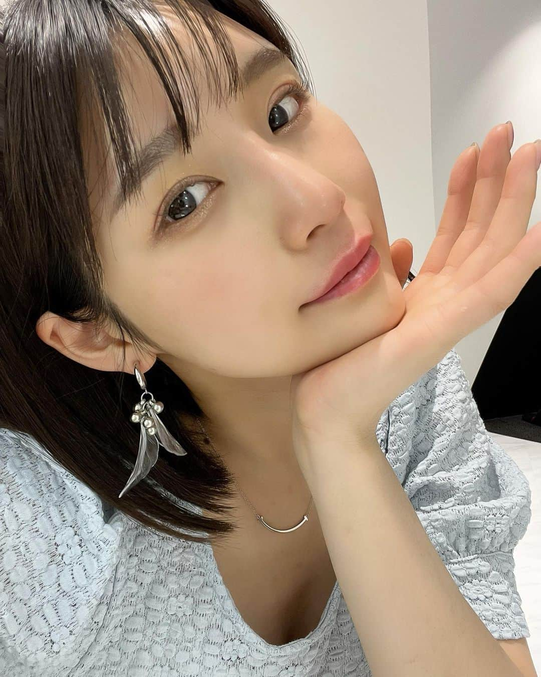 蒼川愛さんのインスタグラム写真 - (蒼川愛Instagram)「人中＋口角ボトックスとヒアルロン酸で優しい印象の笑顔と、ぷっくり唇に🤍 ⁡ 唇って意外と見落としがちだけど、実は顔の印象を左右する大事なパーツということに気づいた🫡✨ ⁡ 前々から唇ヒアルロン酸って腫れるイメージが強かったけど、(他のクリニックの症例みたりSNSでのクチコミみたり、、) さすが程先生…🥹🥹❤️直後でも全く腫れないし、デザインも元の口元を活かしたナチュラルな仕上がりで本当に大満足！ ⁡ @dr_chenglu   @xclinic_ebisu  . 施術を進めながら、 「ヒアルロン酸もう少し足しますか？」とか「今くらいがちょうどいいと思います☺️」とか細かく声がけしてくださるのも安心。 ⁡ 今回は、元々9万円近くするリップの施術が、(ボトックス、ヒアルロン酸混み混み)先生のキャンペーン期間で約4万9000円くらいのお値段で受けられました🫶🏻 (どう見ても破格なのよ…🥹) ⁡  ⁡ ちなみにヒアルロン酸はボルベラです💉 他のヒアルロン酸よりも薄くて柔軟なテクスチャーで唇のボリュームやリップライン形成にぴったりな製剤🤍 ⁡ ビタールライトとかが普通日本だと5万くらいでやってるんだけど、それ2ヶ月くらいしか持たないらしく、、🫣🫣 ジュビダームビスタのボルベラは約1年持ってくれるから質が高い👐🏻 ⁡ ⁡ 私のインスタみてくれた方で程先生をフォローしてくださったり糸リフトや美容施術に興味持ってくれる方が多くいるみたいで嬉しい🫶🏻 これからも惜しみなくリアルなレポを発信＆情報共有していきます🫡🤍 ⁡ . . .  #Xclinic#エックスクリニック#Xclinic恵比寿#スマイルリップ#唇ヒアルロン酸#リップヒアル#美容クリニック」6月10日 20時01分 - tougarashi_suki