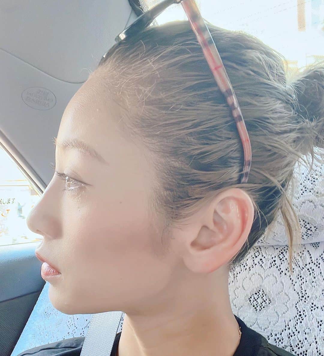 西山茉希さんのインスタグラム写真 - (西山茉希Instagram)「目の下の脂肪粒みたいなのが、 増え続けても放置中。  瞼の上にも進出してきたぞ。  #セルフ手術 #そろそろかな  痛いんだよね。 針。 😩」8月16日 12時07分 - maki.nshiyama50