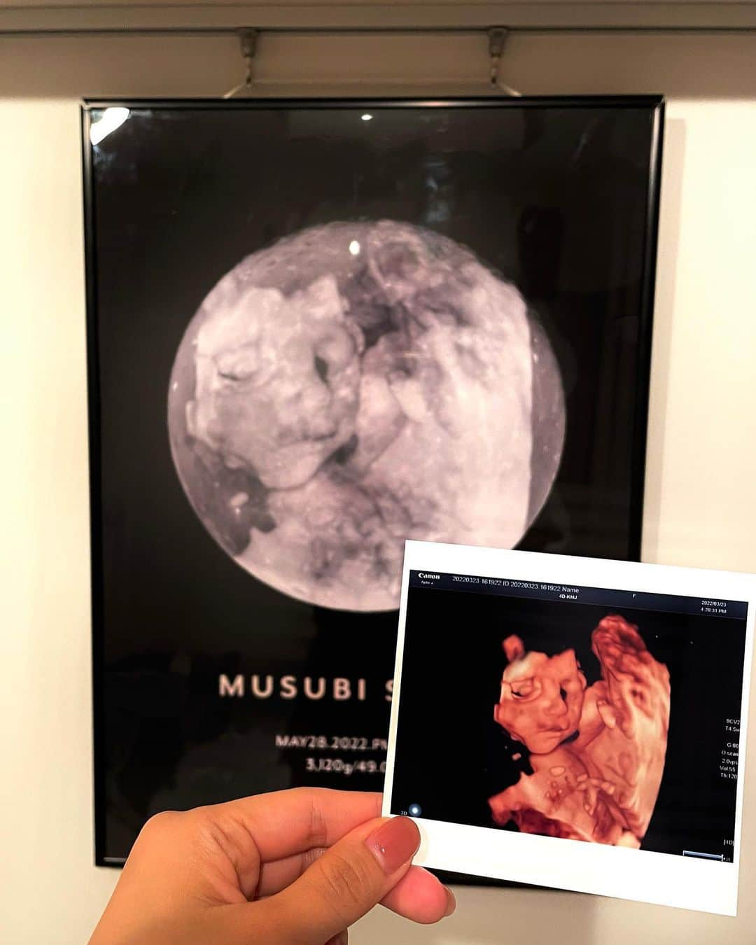 矢端名結さんのインスタグラム写真 - (矢端名結Instagram)「オーダーしていたポスター届いた〜🌙 これよく見るとエコー写真なんです🤍エコー写真って見返す機会が中々ないからこうやって部屋に飾れて大満足！ よく見ないと分からないところもオシャレ🫶 @bank.of.memories   #インテリア #エコーポスター #エコー写真 #BOM #bank.of.memories  #pr #baby #moon #🌙」8月26日 17時57分 - miyu_yabata