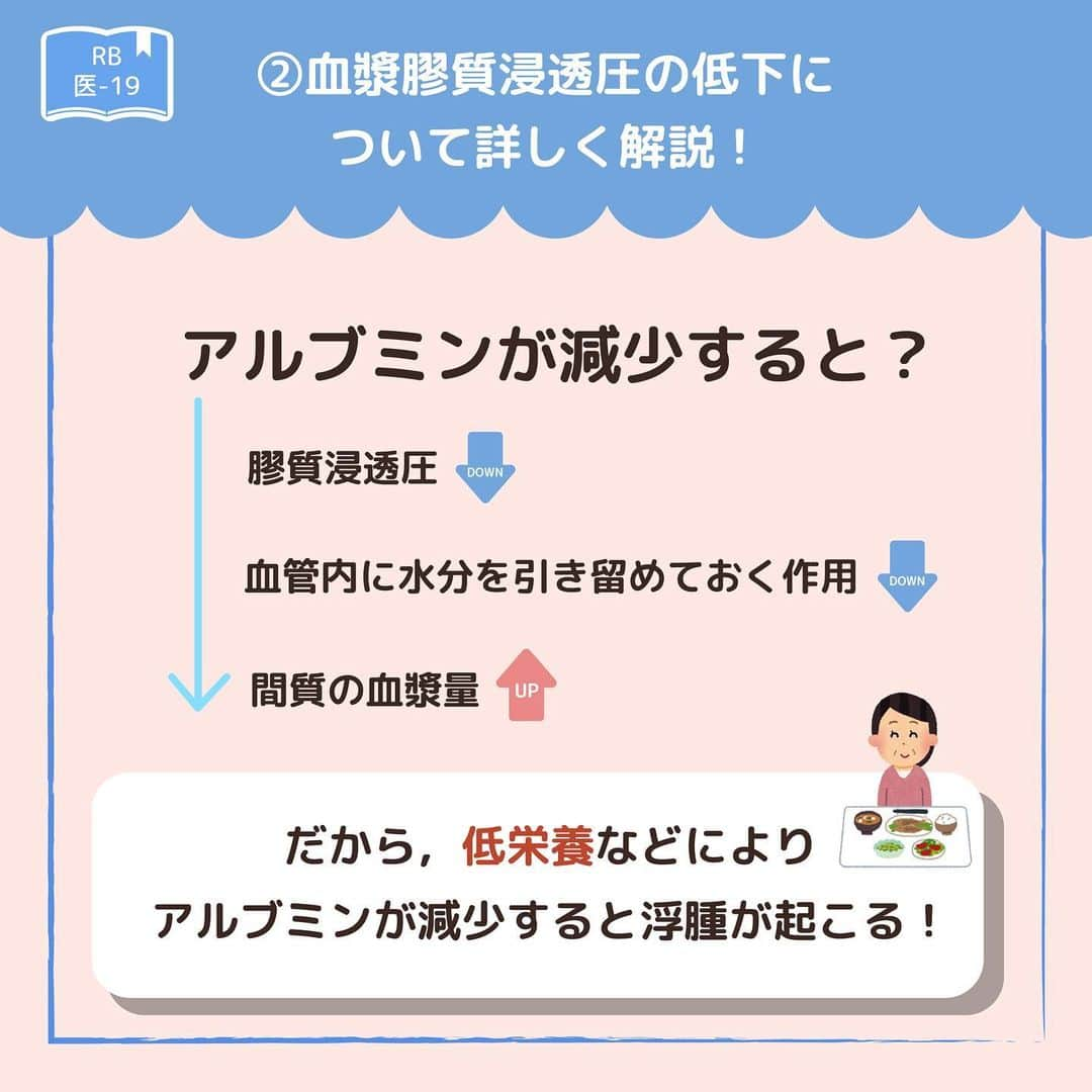 ネコナースさんのインスタグラム写真 - (ネコナースInstagram)「『浮腫』が今回のテーマです！   ストーリー #1日1問 にて正答率の特に低かった問題を投稿にてポイント解説していきます🌼 この問題は特に正答率が低かったので要チェックです💪🏻  浮腫は様々な病態でみられるため，頻出です！ それぞれの病気で浮腫の原因が混ざらないように，きちんと確認していきましょう！  必修問題対策には，必修専用の問題集『クエスチョン・バンクSelect必修』がおすすめです！  書籍『クエスチョン・バンク』や無料アプリ「クエスチョン・バンク」でも詳しい解説が載っているので、ぜひチェックしてみてくださいね🌟  #看護 #看護学生  #看護師国家試験  #第112回看護師国家試験 #第113回看護師国家試験 #第114回看護師国家試験 #第115回看護師国家試験 #浮腫  #勉強垢 #メディックメディア  #クエスチョンバンク  #レビューブック  #アルブミン #膠原病 #低栄養」9月20日 19時18分 - neco_nurse