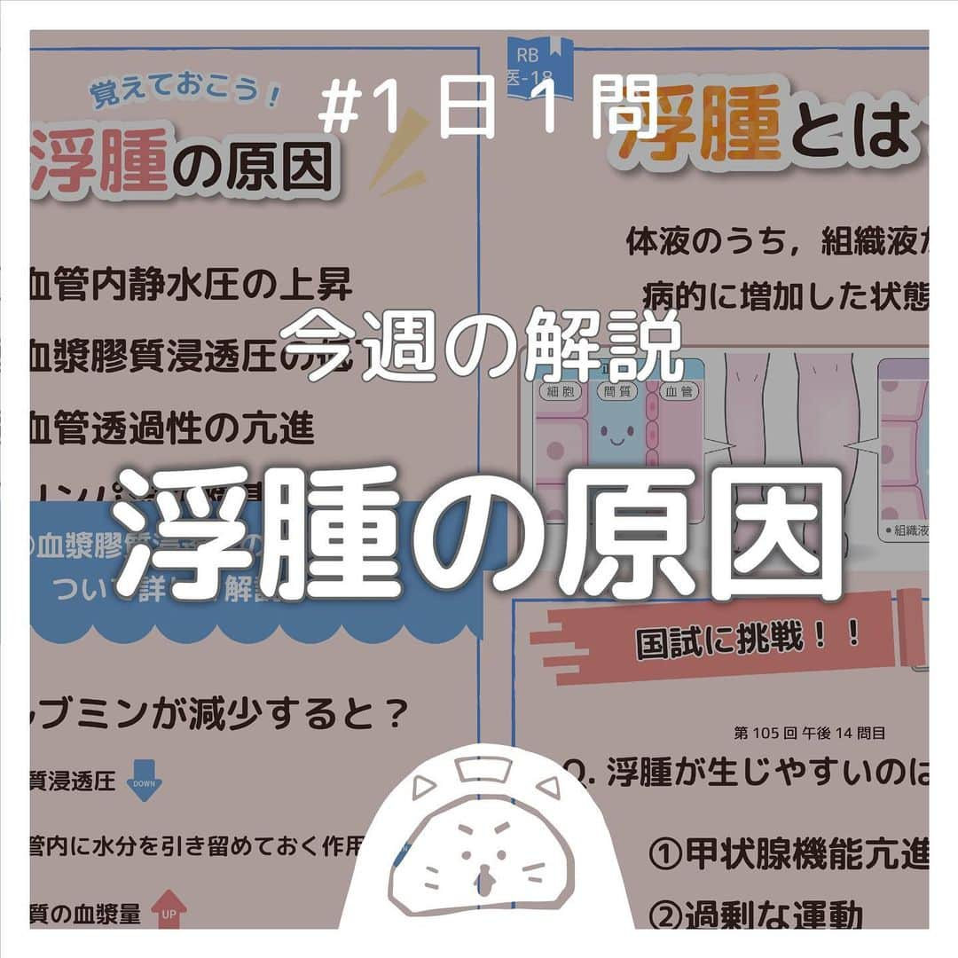 ネコナースさんのインスタグラム写真 - (ネコナースInstagram)「『浮腫』が今回のテーマです！   ストーリー #1日1問 にて正答率の特に低かった問題を投稿にてポイント解説していきます🌼 この問題は特に正答率が低かったので要チェックです💪🏻  浮腫は様々な病態でみられるため，頻出です！ それぞれの病気で浮腫の原因が混ざらないように，きちんと確認していきましょう！  必修問題対策には，必修専用の問題集『クエスチョン・バンクSelect必修』がおすすめです！  書籍『クエスチョン・バンク』や無料アプリ「クエスチョン・バンク」でも詳しい解説が載っているので、ぜひチェックしてみてくださいね🌟  #看護 #看護学生  #看護師国家試験  #第112回看護師国家試験 #第113回看護師国家試験 #第114回看護師国家試験 #第115回看護師国家試験 #浮腫  #勉強垢 #メディックメディア  #クエスチョンバンク  #レビューブック  #アルブミン #膠原病 #低栄養」9月20日 19時18分 - neco_nurse