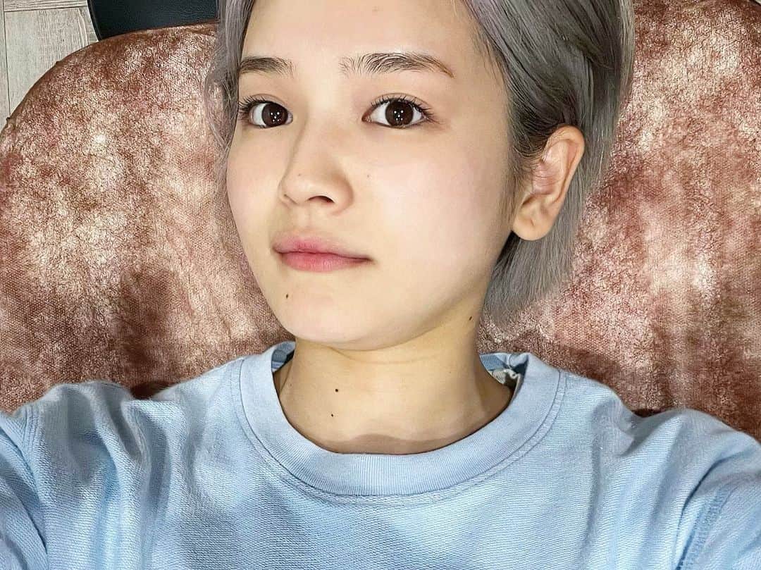 富久美玲さんのインスタグラム写真 - (富久美玲Instagram)「_ . 今回ついに・・・！ . 鼻にあったソバカスとおさらば👃👋 . 1枚目▷施術後1週間経った今日！ 写真では分からない程に薄くなりました🥺  2枚目▷施術前  3枚目▷施術後(赤くかぶれました)  4枚目▷施術後3日が経ったぐらいから 赤みとかぶれも引いたのと同時にポロッと ソバカスが取れて薄くなってました✨ . 施術内容は フォトフェイシャルのルメッカ ➕高濃度ビタミンC点滴 . 担当:工藤ナース . #表参道メディカルクリニック#フォトフェイシャル#ルメッカ#高濃度ビタミンC点滴」9月22日 22時49分 - mirei_official