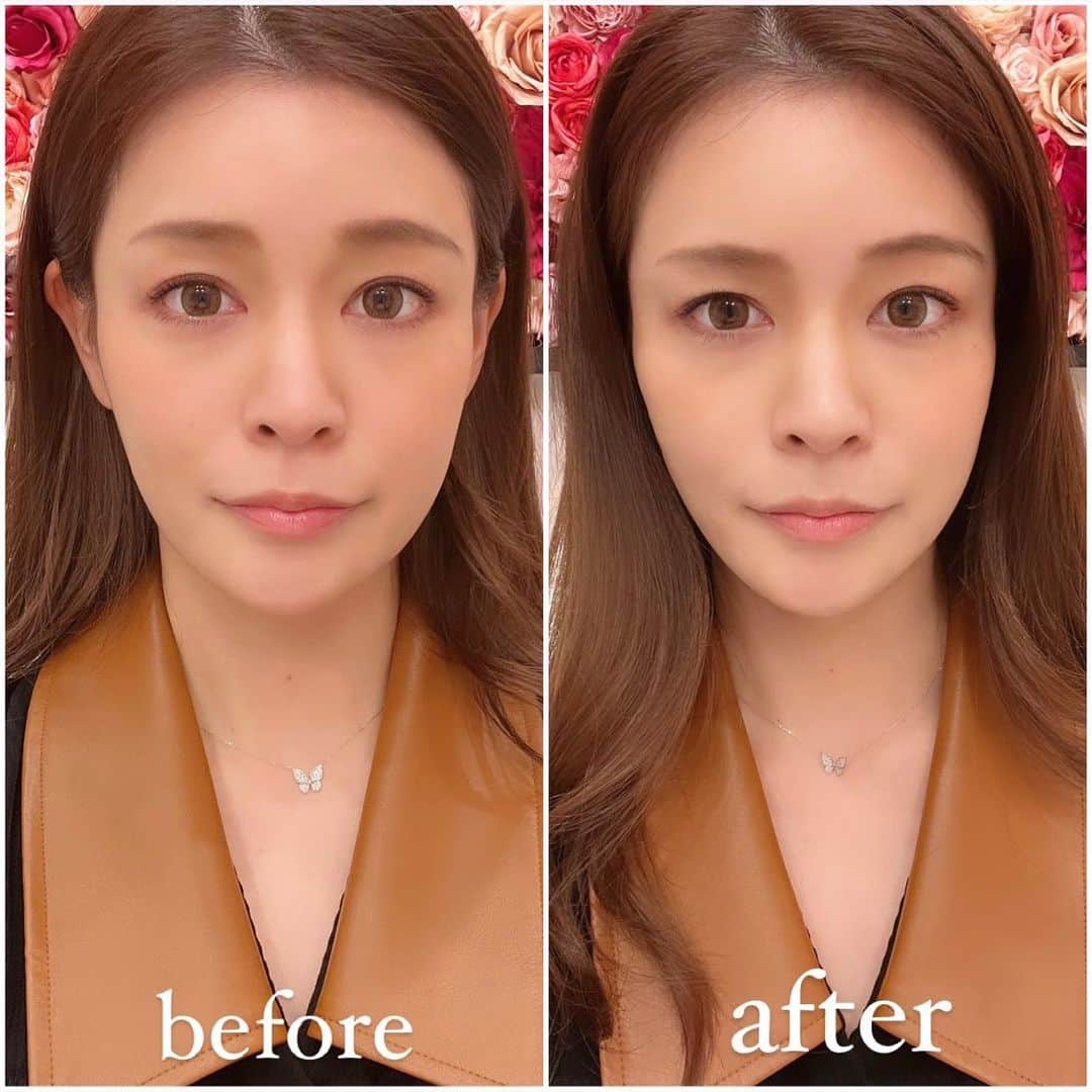 橘メアリーさんのインスタグラム写真 - (橘メアリーInstagram)「🥰💋🥰💋 ・ ・ Aクリニック新宿院@aclinic ...