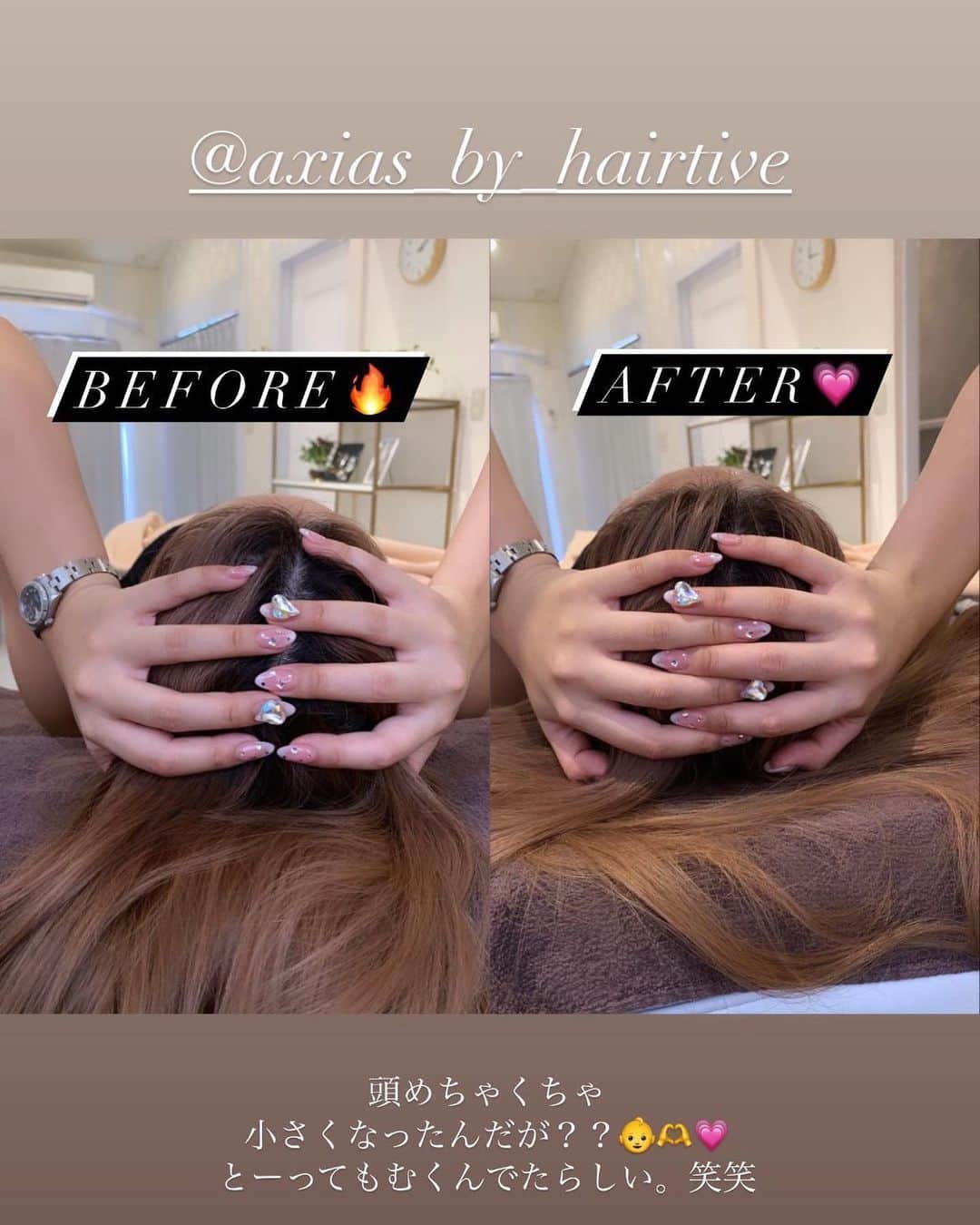 SHIHOさんのインスタグラム写真 - (SHIHOInstagram)「. . #beauty day🖤🖤🖤🖤🖤 . (( @axias_by_hairtive )) . . . 代々木にある完全個室のプライベートサロンさんに 行ってきました〜っ🫶🤍 . この日は #ヒト幹細胞 でのフェイシャル #頭蓋骨マッサージ もしてもらって 頭がめちゃくちゃ小さくなりました🥹💗💗 . . . お肌にたっぷりいい成分を浸透させてもらって プルプルツヤツヤになりました🥰💗💗 . むくみも取れてスッキリしたよ〜！ やっぱり私とにかく浮腫んでるらしい🥲wwww . . . (( @axias_by_hairtive )) thank you🤍 . . . #美容 #美容液 #美容サロン #代々木サロン #ヒト幹細胞培養液 #ヒト幹細胞エステ #頭蓋骨矯正 #美容医療」10月15日 21時55分 - cham_pipi