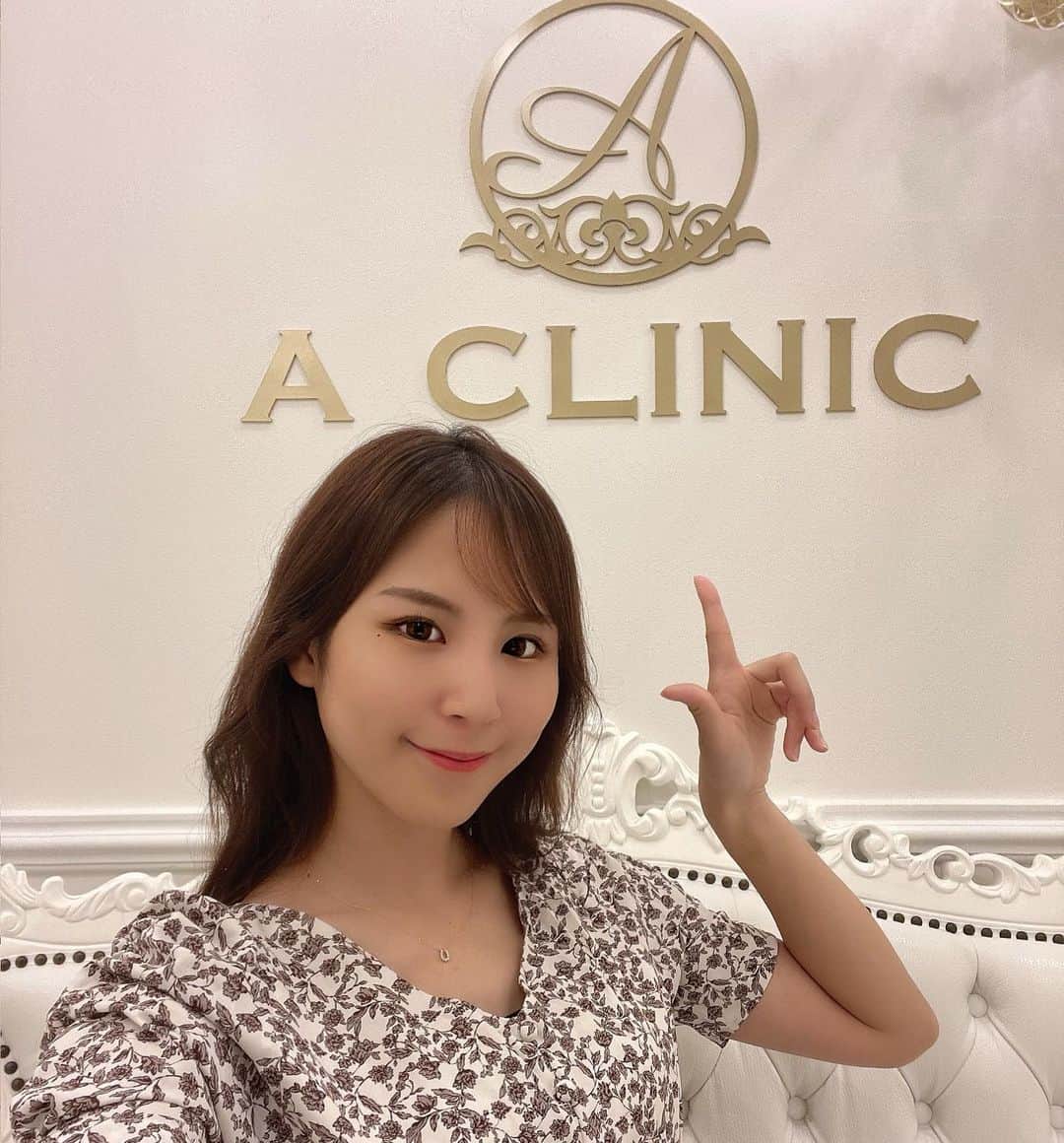 五十川ちほさんのインスタグラム写真 - (五十川ちほInstagram)「𖤐 . . @a_clinic_ginza の惟村先生(@aclinic_koremura)に1day小顔脂肪吸引の施術をしていただいてから、数日経ちました！🧚‍♀️  . 1day小顔脂肪吸引を受けて頬のもたつきがだいぶシュッとした〜🥰 最初の麻酔の針はやっぱりチクチクしたけど、先生が優しく声をかけてくれたので頑張れました\( •̀ω•́ )/🔥 私は体質的に少し腫れやすいのもあるけど、術後の浮腫を差し引いても友達からフェイスラインがあがったねと言ってもらえるのが嬉しい〜🫶♬ これからまだ完成に向かってるので毎日が楽しみ( •̀∀•́ )b . . いまフェイスラインが気になってる方は是非！！ 次はスマイルリップやってみたいなぁ💋♬ . . . #aclinic #aクリニック #エークリニック #aclinic銀座  #惟村公郁 #aclinic横浜 #aclinic新宿 #aclinic名古屋 #aclinic大阪 #美容外科 #美容皮膚科 #1day小顔脂肪吸引 #1day小顔 #aclnic池袋 #aclinic福岡  #脂肪吸引 #小顔 #美肌 #二重あご #フェイスライン #糸リフト #aスレッド #顔痩せ #部分やせ #小顔整形  #小顔になりたい #横顔美人」10月17日 14時03分 - chiho1128_i