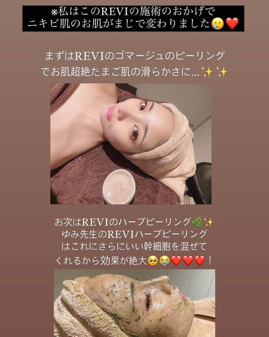 まゆぴちゅーさんのインスタグラム写真 - (まゆぴちゅーInstagram)「お肌ケアday🕊🤍𓈒 𓂂𓏸  以前からお世話になっている エステ界の大先生、 ゆみ先生 @yumisensei_430 のところに 最強肌メンテしに行ったよ〜💗💗  ゆみ先生のところは、即効性もありながら しっかり効果も感じられる施術ばかり なので前から通わせていただいてます🥹🌼  今回は、大好きなREVIの 陶器肌トリートメント🌈✨✨  その前にボディから整えてくれて、 フェイシャルの効果を高めてくれる🥲✨ ゆみ先生オリジナルの施術！！✩  血流が良くなること大事みたい☺️♡！  REVIの陶器肌トリートメントは、 ゴマージュをつかったピーリングと 国産ハーブのみをブレンドした ハーブピーリングもするんだけど、  このゆみ先生がやるREVIのハーブピーリング のおかげで私は肌が変わったと言っても 過言ではありません😭😭🫶🏻🌈🌈！  それぐらい効果ある！！！  特別な幹細胞もブレンドしてくれて、 よりハリツヤが出て毛穴レスになって 美しいお肌に導いてくれます🐝✨✨  ゆみ先生はほんとーーーーに 美容に関する知識が食べ物から何から ほんとに豊富すぎるの🥹🥹✨✨  今回もたくさんお話聞いて、 実際別で購入したプロテインとかあったり🙊笑  お肌や身体のことでお悩み抱えてる方は ぜひゆみ先生に相談してみてください♡  ▶︎ @yumisensei_430 🌼  サロンの場所は、尾山台で、 会員制プライベートエステサロンの @rayhi20 です🫰🏻💗 . . . #REVI #reviハーブピーリング #revi陶肌トリートメント #近赤外線 #骨振動 #肌ケア #美肌ケア #ツヤ肌作り #ツヤ肌 #ニキビ肌改善 #美意識向上委員会」11月16日 16時51分 - mayu_03pichu