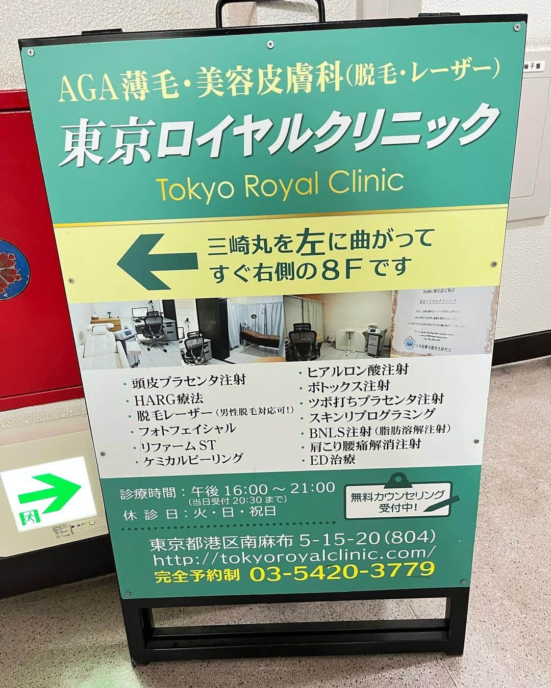 ACOさんのインスタグラム写真 - (ACOInstagram)「またまた広尾の東京ロイヤルクリニック(@tokyoroyal_clinic )さんで脂肪溶解注射(カベリン)を打ってもらったよ〜❣️  1回目から2週間ではっきり効果が目に見えて、思わず2回目もお願いしちゃいました🥹‼️  5回くらいで効果が出るって言われてるから、1回目でこの効果はほんとに感動🥹✨  腫れとかもほとんどないの‼️  恐るべし、カベリン‼️🥹✨  before afterスワイプしてみてね❣️  明らかに顎下のお肉がなくなってる‼️🥹  ホントすごい‼️嬉しすぎる‼️🥹✨  2回目以降更に期待が膨らんでます🥹❣️  小顔になりたい方やお顔のお肉等が気になる方は、是非東京ロイヤルクリニックさんに相談してみてね😉  ちなみに東京ロイヤルクリニックさんでは女性向け施術だけでなく、薄毛治療、ED薬、メンズ脱毛、ヒゲ脱毛等、男性に人気の施術もいっぱいなので男性にもオススメのクリニックだよ☺️✨  院長先生や受付の方も男性なので相談しやすく通いやすいし、その他眼瞼下垂手術や脂肪溶解注射など幅広くメニューもあるので、院長先生こだわりのホームページも見てみてね😘  今なら公式LINE会員になると破格の値段になる施術もあるし、インスタでは様々な症例も見られるので是非フォローしてねん♪  広尾駅から30秒のアクセスのしやすさもgood ❣️  あこもまた近々お邪魔します😘❣️  #東京ロイヤルクリニック#東京ロイヤル脂肪溶解　 #脂肪溶解注射 #カベリン #小顔 #広尾美容外科 #広尾美容クリニック  #小顔注射  #pr #美容  #輪郭」1月22日 17時22分 - acobikini