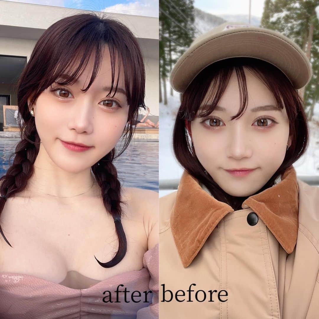 ましゅろ～さんのインスタグラム写真 - (ましゅろ～Instagram)「この前は久しぶりにサロンモデルしてきた✨ ⁡ 施術から1ヶ月くらいたって、東京中央美容外科岐阜院（ @_tcb.gifu ）でのTCB式小顔美肌再生を実感 鈴木大路先生（ @tcb_suzuki_ohoji ）ありがとうございました。 ⁡ ちょっとシュッとなったから、最近痩せた？って聞かれる☺️ ⁡ ⁡ #美容外科ならTCB東京中央美容外科#東京中央美容外科#美容外科#TCB#東京中央美容外科岐阜院#岐阜#美容クリニック#美容医療#美容#PR#リフトアップならTCB東京中央美容外科#TCB式小顔美肌再生#TCB小顔リフト#小顔美肌再生#糸リフト#リフトアップ#小顔整形#小顔#美肌」2月8日 21時21分 - photomasyuro