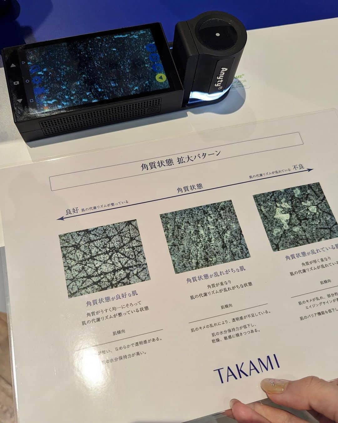 石井里奈さんのインスタグラム写真 - (石井里奈Instagram)「@takami.skinpeel のビューティートークセッションと角質美容体験へ✨ . 美容家の @megumi_kanzaki のトーク。ご本人も本当にお肌がすごく綺麗だから説得力が🙆‍♀️ 私もタカミスキンピールの愛用歴は3年くらいになりますが、塗った後3分置くのをついやらずにスキンケアしてたけど、今回その3分がいかに大事でお肌がどう変わるのか学び、神崎さんも3分置くだけで本当違うと話してたのできちんとケアしたいと思います！！ . 角質って取り除かなきゃ！ってイメージだけどケアしてあげるのが大切。肌表面の0.02mmだから本当に優しく摩擦なくケアしてあげることが大切なんだね！ 角質ペーパー体験していかに自分のスキンケアの時の肌への圧が強すぎたのか驚きでした笑 . 洗顔は泡切れのいい濃密泡を挟んで優しくケアしてもしっかり綺麗になってさらに透明感が出て感動でした💓 . 現在の角質チェックでは前回やった時よりも大分整って改善されてて！あとは乾燥が大敵なのでしっかり保湿も頑張りたいと思います💓 継続は力なり🔥 おうちでのホームケアの様子もまた投稿するね❣️ . #takamiskinpeel #タカミ #タカミスキンピール #角質美容 #PR #角質ケア #美肌 #艶肌 #スキンケア #おすすめスキンケア #継続は力なり」2月24日 18時21分 - ri7tin1025