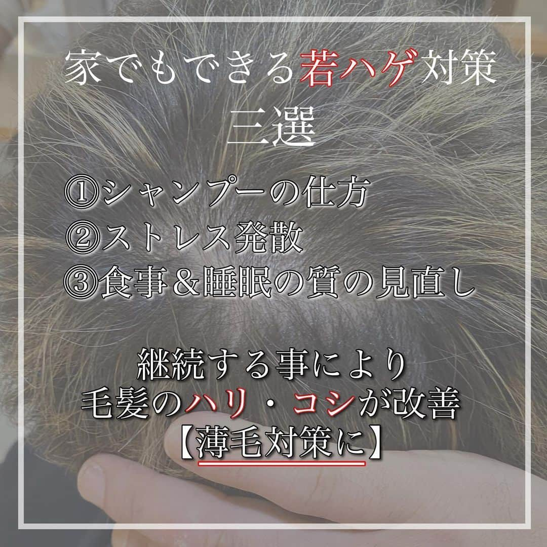 クニさんのインスタグラム写真 - (クニInstagram)「.みんな以外と知らない【若ハゲ】の話し。 . .前回の以外と知らないシリーズでは【原因】から【特徴】の話をしました◇ . .それを踏まえて、今回は【家でもできる予防法】です◇◆ . . .継続する事によって、ハリ、コシが改善されて、薄毛対策に繋がります◇ . .シャンプーに関しては付随で .洗浄力の強すぎないアミノ酸系シャンプーがおすすめ◇ .洗いすぎ、爪を立てるといった間違った洗髪を避けましょう♪ . .ストレスは人それぞれ違うので、うまく自分に合った発散法を探しましょう♪ . .食事に関しては、 .喫煙や大量の飲酒も🙅‍♂️ .血流悪化や、悪性男性ホルモン増加に 影響してしまいます。。。 . .健康的な生活を心がける。 .髪にも身体にも大事な事ですね◇ . .また、ここでは書き切れ無い内容も沢山あります。 .ご来店の際、是非相談ください♪ . .世界特許を取った、抜け毛防止、発毛促進の商材も取り扱ってます◇ . .悩む事がストレス。やれる事はやって、しっかり対策していきましょう🤝 . .それでは .全国のメンズ達よ .『かっこよく』あれ。 . .また次回以降、髪に関して疑問や知りたい内容などありましたらコメント下さい♪ . .全力でお答えします◇◆ . . #薄毛対策 #ハゲ対策 #抜け毛対策 #発毛 #育毛」2月24日 20時34分 - kunikuni99