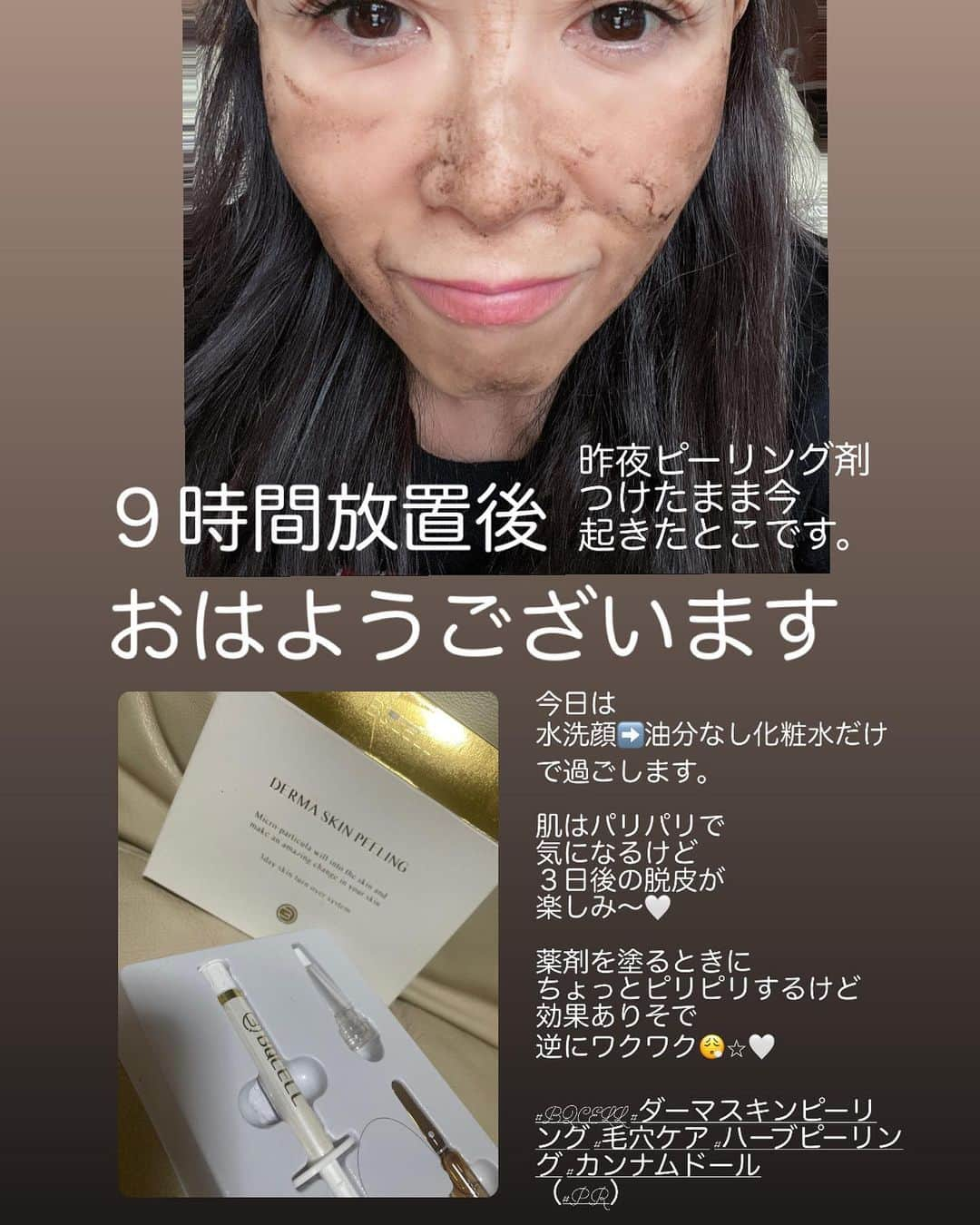 Naoko（なおこ）さんのインスタグラム写真 - (Naoko（なおこ）Instagram)「☺︎ ☺︎  BQCELL(ビーキューセル) ダーマスキンピーリング ハーブピーリング セルフ ケア  を やってみました  （投稿順番が 時系列ではなくて ごめんなさい🙇‍♀️）  エステでやるやつ うちでやる感じ  ちょっと緊張しましたが やってみたら すごく簡単 ただ チカチカピリピリは します。  注射器に入ってる 薬材を塗布し、 そのまま寝るだけ。 （７時間以上放置）  ダウンタイムが必要だから おやすみ前がおすすめ。 素顔で２日間過ごします。 皮膚が無防備な状態で 日焼け注意なので わたしは２日間カーテンしたまま、部屋からでてませんでした。  1️⃣３日目までは 油分のあるスキンケア禁止  2️⃣メイクも油分があるから なるべく禁止  ４日めからは皮膚が剥離してくるから 保湿をいつも以上に気をつけてあとは 通常どおり。  若い人は ターンオーバーが はやいので、 より効果あるみたい。  ゆでたまご肌に なるといいね。  土日は、 うちに引きこもり 地球の誕生や、 登山家のドキュメンタリーや（またか！） みまくって、文明社会との ギャップに萌えた なおこなのでした。  ダーマピーリングで 肌の生まれ変わりと 同時に ネイチャーなおこが 誕生したようです。  おぎゃー！ すぐに 影響されてはまる性格 まだ健在、、笑  #BQCELL #ダーマスキンピーリング #毛穴ケア #ハーブピーリング #カンナムドール （#PR） #筋トレ女子 #フィットネス女子#フィットネス#Fitness#筋トレ女子と繋がりたい #筋トレ好き#筋トレ好きと繋がりたい#減量 #くびれ#美ボディ #アラフィフ#アラフィフコーデ#ボディメイク #50代#健康 #熊本 #kumamoto」3月5日 16時58分 - smile_naohibi