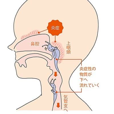 ヒデトレのインスタグラム：「ここに悪魔がおります🦠👾😈 . 吐き出すのです🤧🤮😤😭 #detox  #鼻うがい　#ドレミファうがい　#塩水 　#ヒデトレ ⚠️鼻うがい後は、ちゃんと鼻腔の水を下向いて出し切ってね😊」
