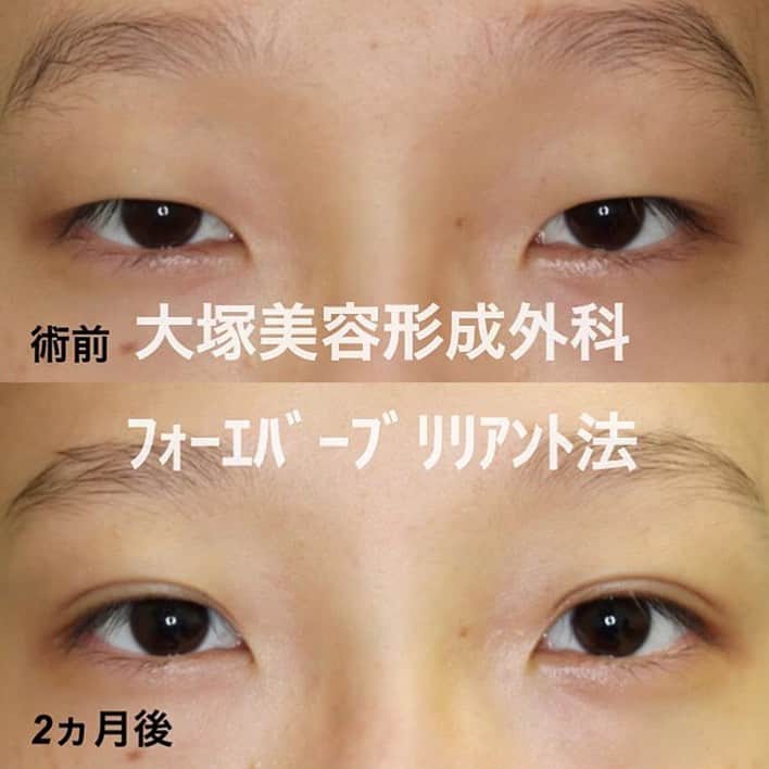 ミライ美デザイン｜大塚美容形成外科・歯科のインスタグラム