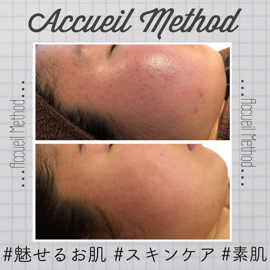 肌質改善専門サロン~Accueil~のインスタグラム