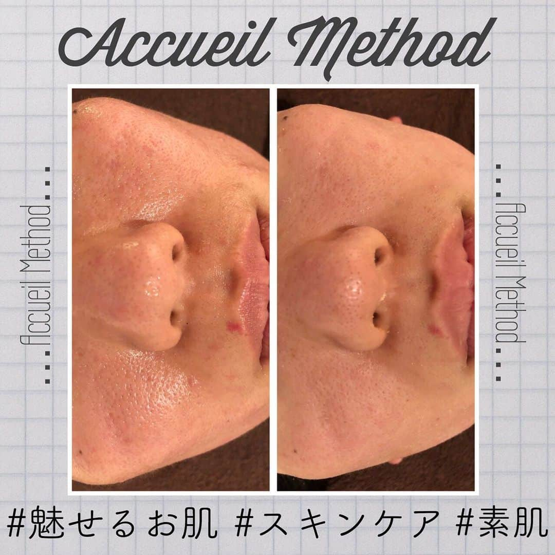 肌質改善専門サロン~Accueil~のインスタグラム