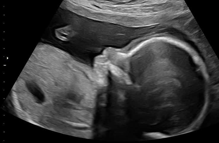 ジェシー・カーマイケルのインスタグラム：「Our Second Baby Boy...❤️✌️❤️👼❤️😍❤️💫❤️🌝❤️🦁❤️」