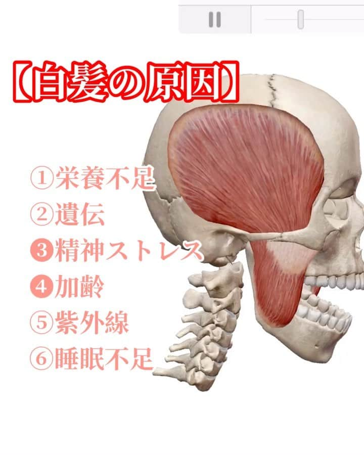 y1735kのインスタグラム：「投稿⑴ 動画です📽 ・ 【白髪】【整顔】【小顔】についてのpostになります。 ・ 3分半程の動画になりましたので、4回　にわけて投稿させて頂きますね👏。 ・・・・・・・・ ・・・・・・・・ 『かたさ』は老化を加速する。 と日々感じます。 ・ 白髪やお顔の歪み、たるみは　『かたさ』をゆるめる事で　緩和されたり予防されると思うんです☝️ ・ もちろん 白髪の原因はいくつかありますが（動画1枚目記載）、日々情報社会で過ごし、頭を使うことが多くなっている現代人にとって、❸精神的ストレスゆえのかたさは大きい要因かなと思うんです。 ・ 髪をかき上げた側頭部。 ここの筋肉を【側頭筋】といい、ラテン語では【temporalis】と言います。意味は【時】。この部位の表面にある髪が白くなることにより【時の流れを悟る】とされる。 ・・・・・・・・・・・ 図も踏まえて　動画を作ってみました。 参考になると幸いです。 ・ #頭蓋骨 #側頭筋 #小顔 #白髪対策 #bodymake」