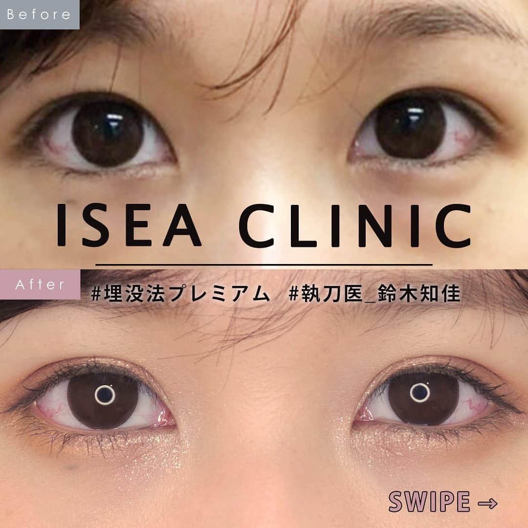 東京イセアクリニックのインスタグラム