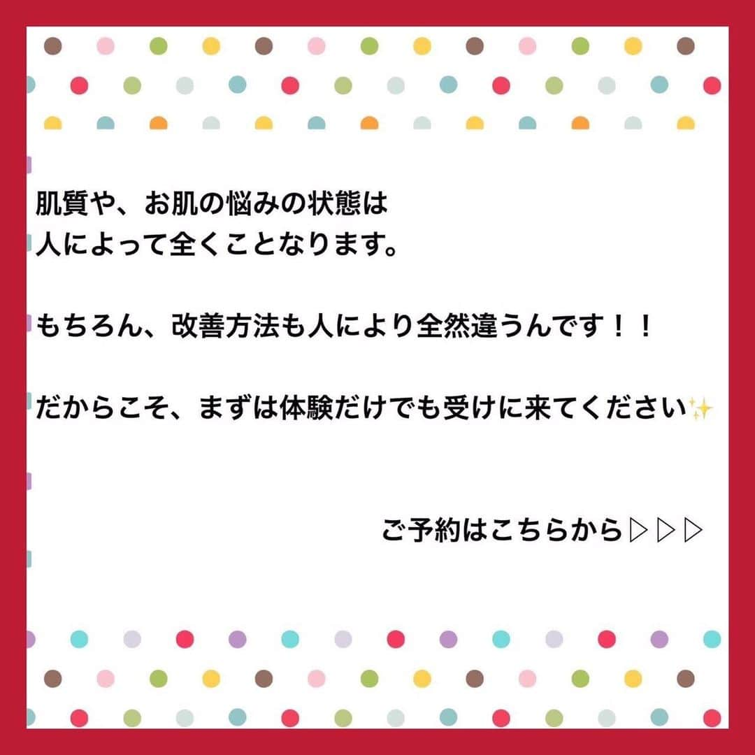 肌質改善専門サロン~Accueil~さんのインスタグラム写真 - (肌質改善専門サロン~Accueil~Instagram)「💙💚18日空きあり💛💜❤ * * 【ご予約はこちら👇🏼】 🌟🌟 @accueil_ikebukuro 🌟🌟 . ※今だけ期間限定クーポンあり . . . 肌荒れの原因は人それぞれなのにも関わらず、 周りの人と同じケアをしていませんか💦？？ * ❌お薬を塗っても飲んでも変わらない、、 ❌食事を気にしても肌が荒れる、、 ❌スキンケアを変えてもイマイチ、、 ❌何かしら常にトラブルが肌にある、、 ❌ニキビが繰り返しできる、、 * * そのお悩み解決できちゃいます😌✨ Accueilは、どのサロンに行っても良くならなかったお客さまたちや、 どの皮膚科に行っても変化がなかったお客さまたちが多く訪れてくださっています🙌💕* * * * もう悩まない！！！ 繰り返さないところまでしっかりと根本改善していきます☺️ そろそろ肌荒れから卒業しませんか？ * →→→初回体験はこちらから👉🏼 @accueil_ikebukuro * * * * Accueilでのお手当は、、 * 機械は一切使いません🙅‍♀️❌ 使うお化粧品は １００％天然の「ミネルヴァ化粧品」🌲🍃 ニキビの炎症がある方・アトピーの方でも 安心して受けていただける事ができる お肌にとても優しいエステです♡♡ * * お肌のお悩みなら、何でもお任せください😊💕 * * ■「インスタ見ました！」 で、 初回体験￥26,000 →→✨￥５，９８０✨ * * * --------当サロンのご予約方法≫--------- *  1️⃣当サロンのインスタTopのURL ⭐『Hotpepper Beauty』の 「instagram限定クーポン」にてご予約可能♡♡ * * 2️⃣インスタのDMからご予約 （下記項目を記載の上、お問い合わせください♪） * 🔶お名前（フルネーム） * 🔶お電話番号 * 🔶希望日時（第１～第３希望） * 🔶ご希望のメニュー * * 3️⃣お電話でのご予約✨ 　03-6912-5705にお願いします♡ ----------------------------------------- * * @accueil_ikebukuro ✨ #ニキビ #ニキビ跡 #毛穴 #乾燥肌 #ニキビ跡ケア #肌荒れ #ニキビ跡改善 #ニキビ肌改善 #ニキビ治療 #保湿 #毛穴の黒ずみ #毛穴の開き #スキンケア #毛穴吸引 #アトピー女子 #ニキビ皮膚科  #美肌ケア  #ニキビ専門 #肌質改善 #背中ニキビ #アトピー肌 #乾燥 #ニキビケア #毛穴ケア #アトピー治療 #肌悩み #スキンケア難民 #肌トラブル改善 #スキンケア大事 #目指せ美肌」7月17日 14時00分 - accueil_ikebukuro