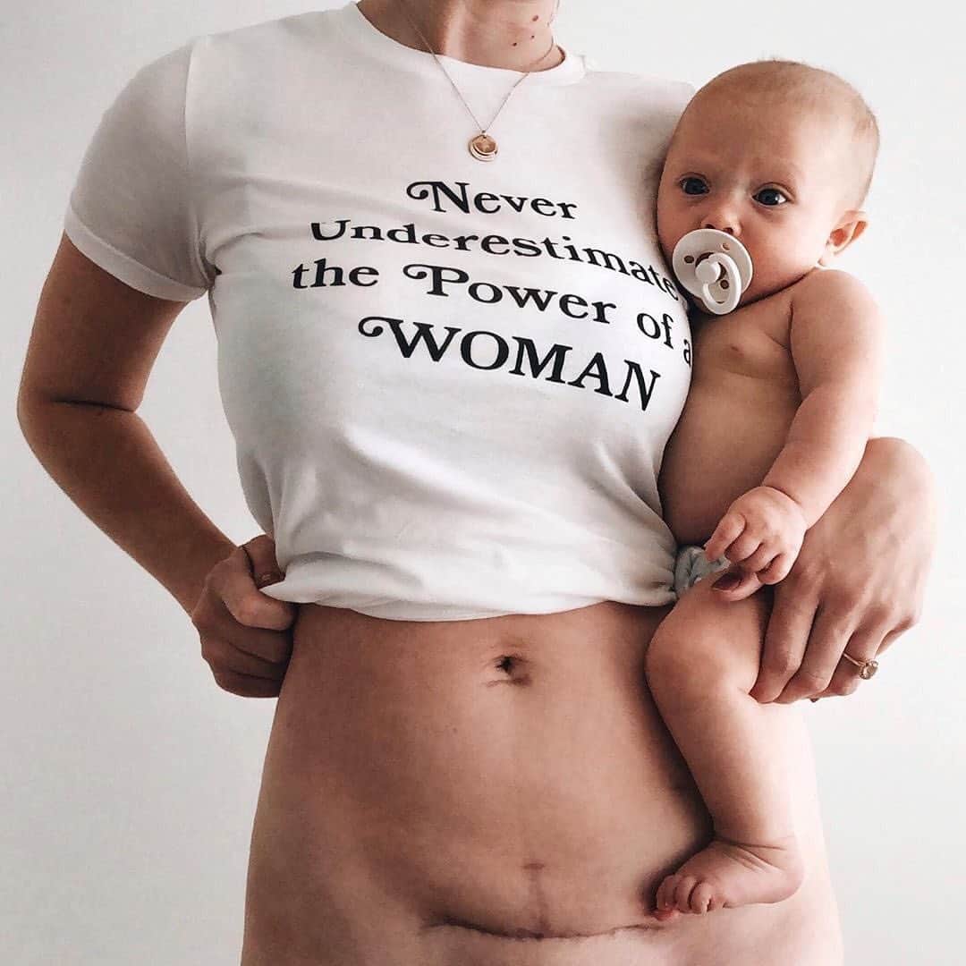 The Honest Companyさんのインスタグラム写真 - (The Honest CompanyInstagram)「"Women’s bodies are so amazing and I think sharing the raw aspects of motherhood is so important. Our daughters (and sons) deserve to know about what the human body goes through in order to bring them here." 💪 We couldn't agree more, @happyandgray 💕」7月20日 1時02分 - honest