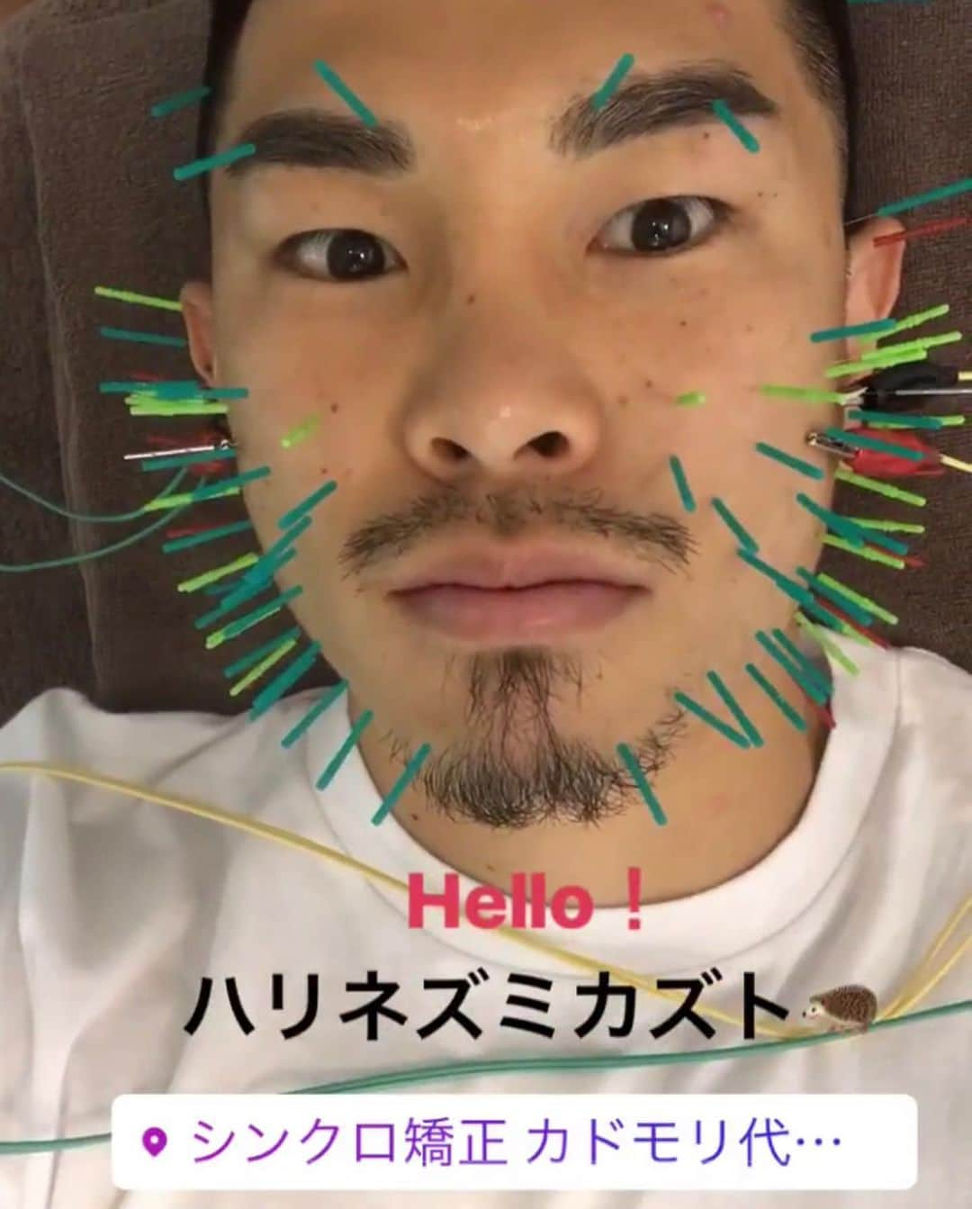 角森脩平さんのインスタグラム写真 - (角森脩平Instagram)「. 格闘技の外傷ケアから生まれた カドモリ式🤗 格闘家の顔骨を触ると初心にかえる気がします😌 一翔 @kazuto_ioka_official  日本人初!4階級制覇‼︎ おめでとう。 . . #井岡一翔#boxing#KADOMORI #シンクロ整顔矯正#シンクロ小顔矯正#シンクロフェイシャル#ハリネズミ美容鍼#日本の技術を世界へ#世界のKADOMORI #角森脩平」7月21日 18時17分 - kadomori570731