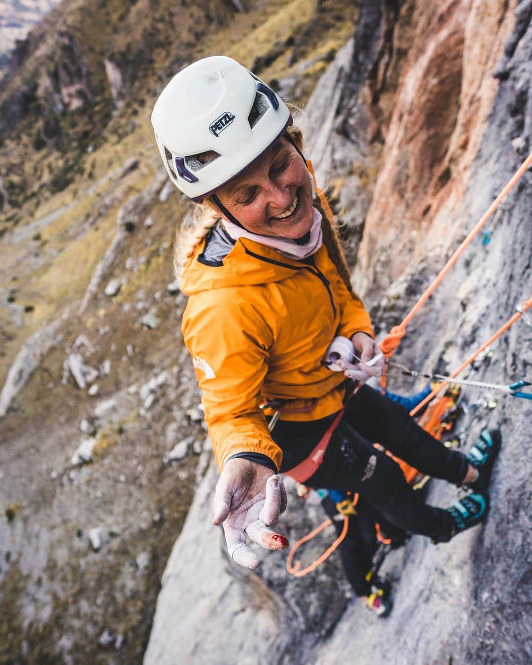 エミリー・ハリントンのインスタグラム：「It’s FINE. 💉 // 📸 @honngy // @thenorthface_climb」