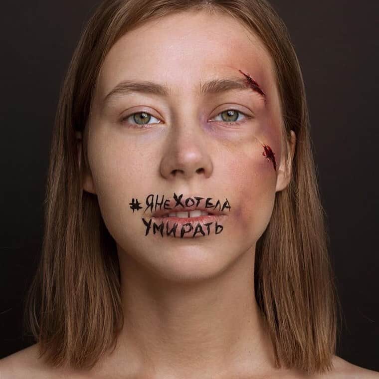 NBC Newsさんのインスタグラム写真 - (NBC NewsInstagram)「Russian women are posting selfies on social media showing their faces covered in fake cuts and bruises to protest Russia's domestic violence law, under which abusers face a $500 fine or 2 weeks in jail. Click the link in our bio for more. . 📷 Lara Arbatskaya」7月26日 10時55分 - nbcnews