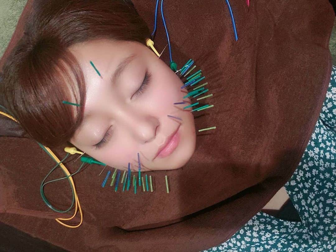堤ゆきみのインスタグラム：「気になっていた美容鍼に行ってきました🥰﻿ ﻿ 浮腫みが1番の悩みで、終わった後にはびっくりするほどスッキリ！﻿ あと電気を流すんだけど、すごい顔が動いてかなり衝撃的でした。。﻿ ﻿ 鍼は少し怖いイメージもあるけど、担当してくれた院長の杉崎先生の丁寧で分かりやすい説明もとっても安心できました。﻿ ﻿ またよろしくお願いします😋﻿ ﻿ #杉崎先生 @sugizakikenya﻿ #きゅきゅっと美容鍼﻿ #BCARAT式美容鍼﻿ #BCARATbykoritorinic﻿ #BCARAT #Beauty #Body #Balance﻿ #笹塚 #笹塚美容鍼 #美容鍼 #美顔鍼﻿ #同僚に見せたらこういう生き物みたい﻿ #って笑われました﻿」
