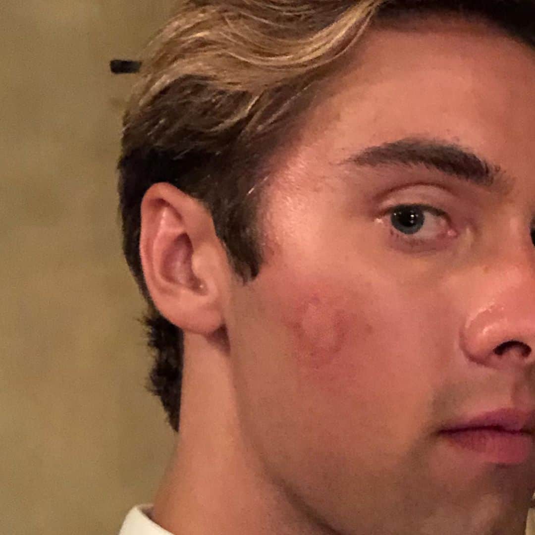 オースティン・ノースのインスタグラム：「Boy oh boy I love it when mosquitoes bite me when I’m trying to film a scene!」