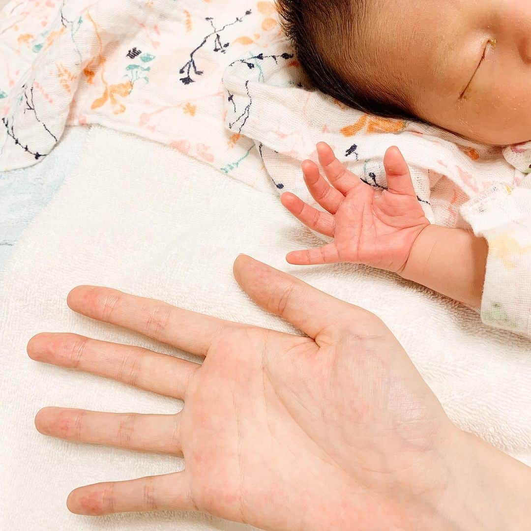 しほの涼のインスタグラム：「母乳育児の大変さに困惑しております😓 繊維線腫で2回手術をした左のおっぱいが乳腺が切れてしまっているらしくカチコチになってしまい😫😫 娘も硬いから左は吸いづらいみたいで、左吸わせると大泣き😭 母乳外来に行きながら死ぬほど痛い助産師おっぱいマッサージをされながら頑張っております😅 完全母乳でやりたかったけど、この子が求める量と比例しなくて ミルクを足しました。 ミルクは消化が遅く3時間空けなければいけないとか書いてあって、母乳のが消化に良いしこの子の身体に負担をかけてるのが嫌で、、、 人工物であるミルクを与える事に罪悪感があったけど、今のミルクって凄いんですね。 母乳に限りなく近付けてくれているのが多くて、栄養もいっぱい入ってるんだって。 この子がお腹いっぱいになる事が今は大切なのかな？ 母乳100%とはあまり考えない方がいいのかな？って思えてきました。  初乳には免疫が沢山含まれてるって聞いてたので、それはどうしても飲ませたくて最初は飲まれるのに慣れてないので乳首痛すぎたけど、なんとか初乳は1週間飲ませられました😌それは自己満足かもしれないけど、本当に良かった😌  早く左のおっぱいも上手にやれたらいいな。 一緒に頑張ろう、娘ちゃん。 日々が嵐のように過ぎていくので、備忘録として書いておきます、 娘が成長した時に母として幼かった自分のありのままの気持ちを残しておこう😌 #母乳育児 #母乳問題 #母乳マッサージ  #母乳相談室 #ピジョン #Pigeon #新生児 #新生児育児 #母乳 #赤ちゃんのいる生活 #赤ちゃん写真 #赤ちゃん #令和元年ベビー #令和元年生まれ #赤ちゃんのいる暮らし #手 #ミルク #ほほえみキューブ #ほほえみらくらくキューブ #ママリ #ベビーフォト #新元号ベビー」