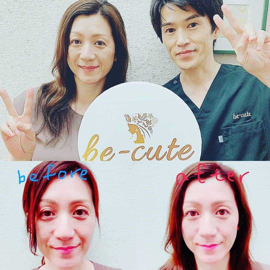 野々村友紀子さんのインスタグラム写真 - (野々村友紀子Instagram)「昨日は神戸の修士くんの実家に子供達と私だけ帰省！ 楽しい時間を過ごしたその帰り、親戚の皆さんが子供達と遊んでくださるというので、前から気になっていたコルギ（小顔になるやつ）に行って来ました😭こんな一人ゆっくり時間は久しぶり😭スッキリ気持ち良かったです。 ・ どうでしょう。左がやる前、右がやった後。目の周りのクマとかたるみが減ってスッキリ目がデカくなった気がします。ほうれい線とかも薄くなった！コルギ！すごいやんか！ ・ 元町駅からすぐの【be-cute（ビーキュート）】イケメン店長のいる小顔サロン、おススメやでー #コルギ #元町 #ビーキュート #be-cute #野々村友紀子 #どったん修士 #ドッキリGP #ありがとうございました」7月28日 15時03分 - nonomura_yukiko