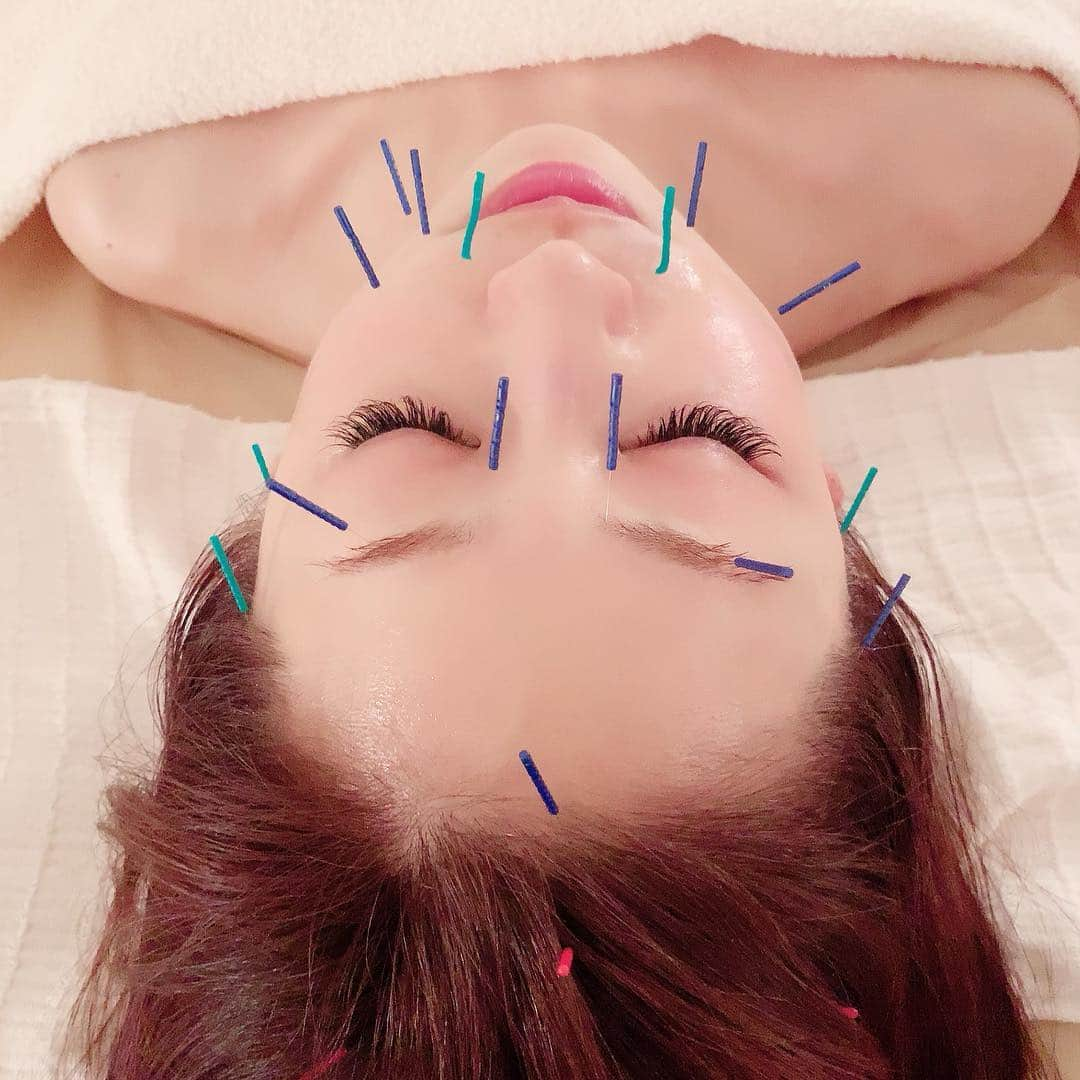 和泉佳子さんのインスタグラム写真 - (和泉佳子Instagram)「週末は、行きつけサロン「鍼美salon ゑまひ」で小顔ケアをしていただきました♥️ . 実は、こちらのサロン麻布十番にある小さな、小さなサロンなんです・・・ . 予約が取りにくくなるのが怖いので、本当は内緒にしておきたいサロンなのですが😆（笑） . まずは、WINBACKというインディバに類似した効果の特別な装置を手首につけて身体の深部まで熱を伝えてリンパマッサージをしていただき老廃物を流してリフトアップ✨ . 最後は、美容鍼でリフトアップを形状記憶させるようにお顔や頭にも美容鍼をうっていただきます😌 . ゑまひさんでこれをやっていただくと、フェイスラインがスッキリして、お顔が立体的になって小顔効果大なんです⬆️⬆️⬆️ . 施術直後はもちろんですが、3日後くらいが一番お顔が上がるらしいので、明日のQVC出演の時は、どうか小顔ケアの効果が出ていますように😌💕（笑） . .  #和泉佳子 #25ans #エレブロガー  #ヴァンサンカン #小顔ケア #行きつけサロン #麻布十番 #鍼美salonゑまひ #美容鍼 #winback #リフトアップ」7月29日 22時33分 - yoshiko_izumi