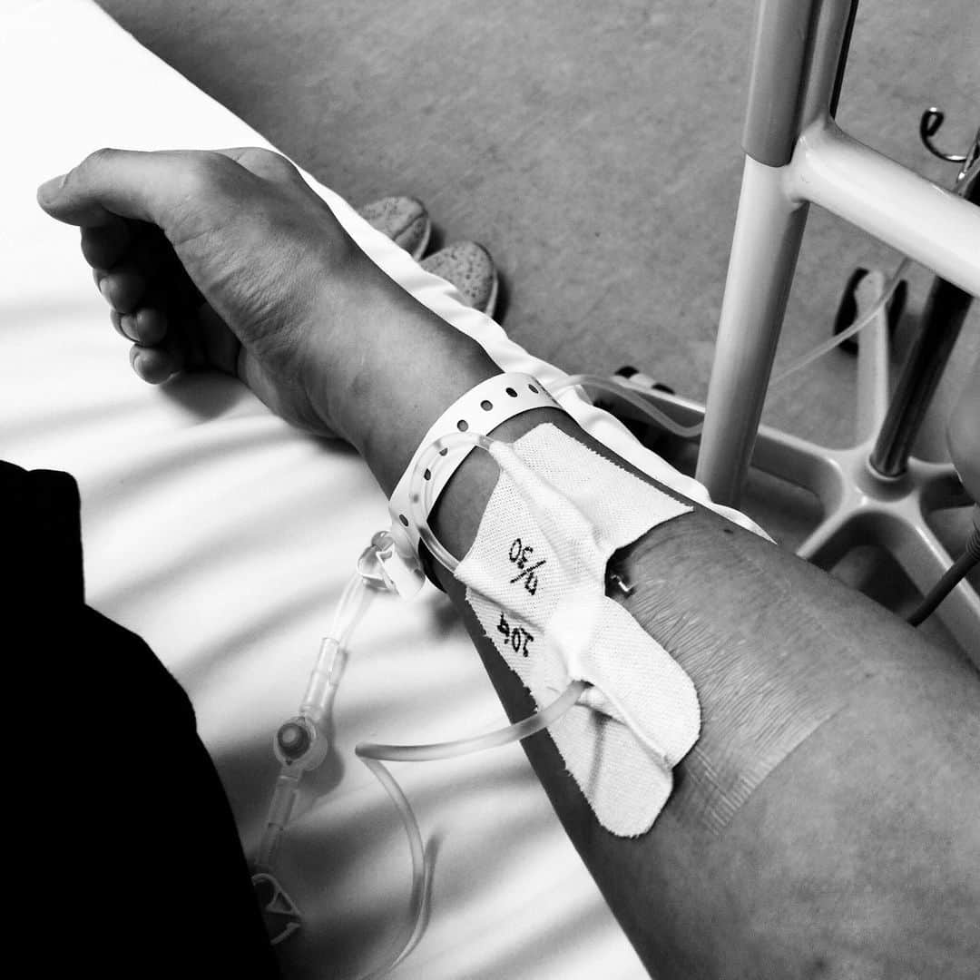 宮上元克さんのインスタグラム写真 - (宮上元克Instagram)「長年悩んでいた頸の手術を決行 これでまた思いっきりドラムをブッ叩けると思うと嬉しくて堪らない🤣」8月1日 20時55分 - motokatsu_dr