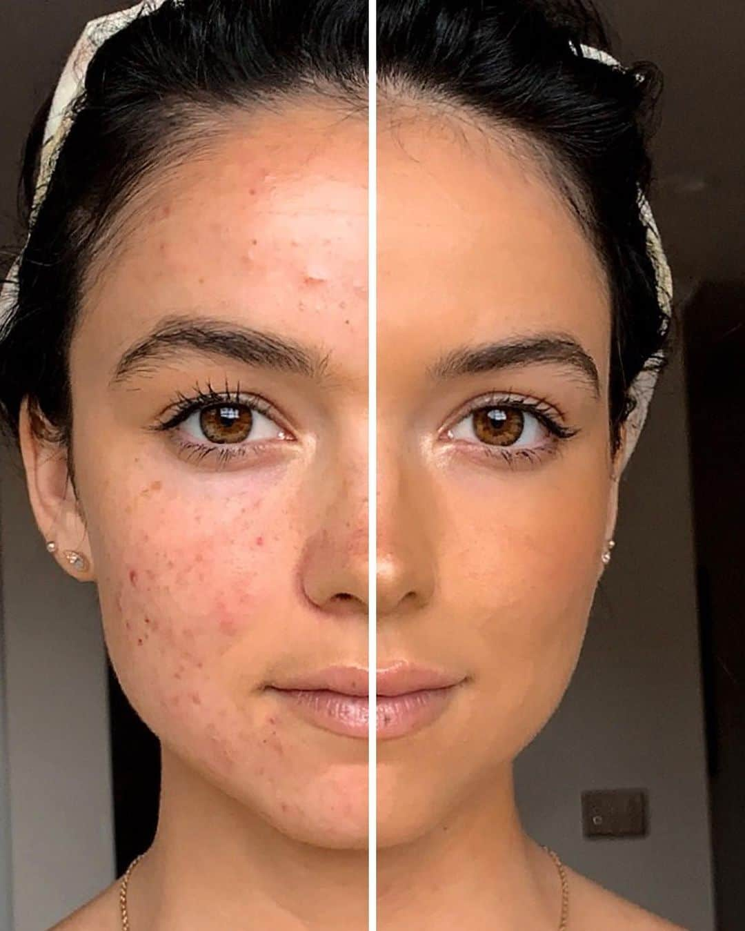 BECCAさんのインスタグラム写真 - (BECCAInstagram)「Ultimate Coverage 24 Hour Foundation is totally non-acnegenic and won’t clog pores so you can be seen for you. Head to our #InstagramStories to hear more from our friend @Bekah on what it means to be seen. #BeSeenWithBECCA」8月4日 0時02分 - beccacosmetics