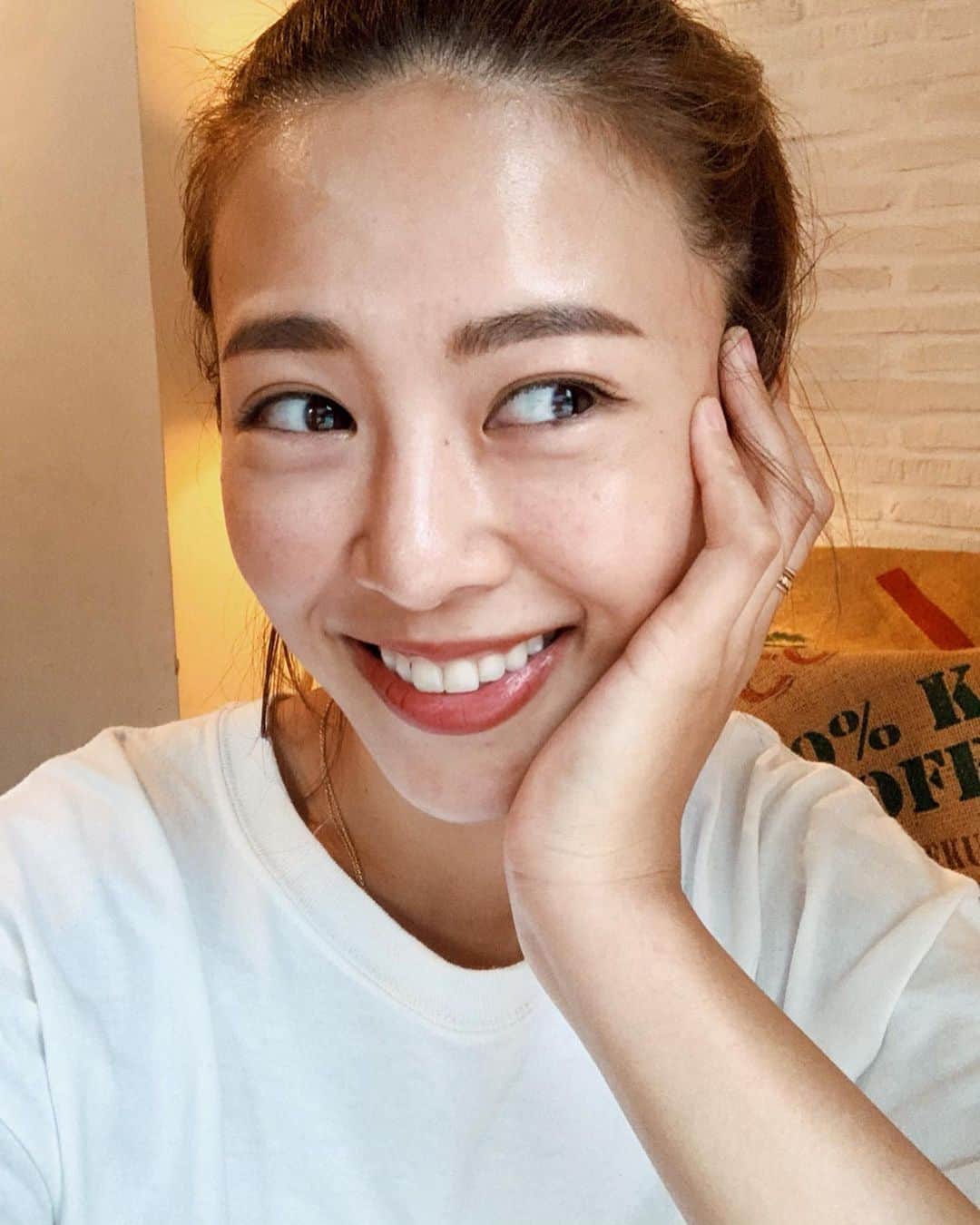 のインスタグラム：「美容の話🧡🧡🧡 . 毎月のお楽しみ @tokyo_biyo_hifuka へ行ってきました🤩 . 今回も院長先生に相談して今の悩みに最適なサーマクールFLXを受けることにしました✨ . サーマクールFLXは ①顔のたるみが気になる ②顔のボリュームを落としたい ③フェイスラインがたるんでいる ④小顔になりたい ⑤毛穴を引き締めたい ⑥肌のハリが欲しい という方におすすめな施術なんです☝️ . 前回は半年前に通常より弱いレベルで受けたんですが今回は通常の強さでしっかりかけてもらいました🔥 . サーマクールって好き🥰 . 痛みというより熱さを感じる施術だから痛いという感覚はなくて好きなんだ🤪w . 綺麗になるにはある程度我慢も必要だと思うけどこれなら我慢できるっ💘💘💘 . 本当に信頼できる先生たちがいて、通うようになってから気になってたフェイスラインがスッキリしてきたよ💭😍 . いつもありがとうございます🙏 . #東京美容皮膚科クリニック #サーマクールflx #サーマクール #hifu #ハイフ #小顔効果 #たるみ改善 #ウルセラクリニック #サーマクールクリニック #切らないたるみ治療」