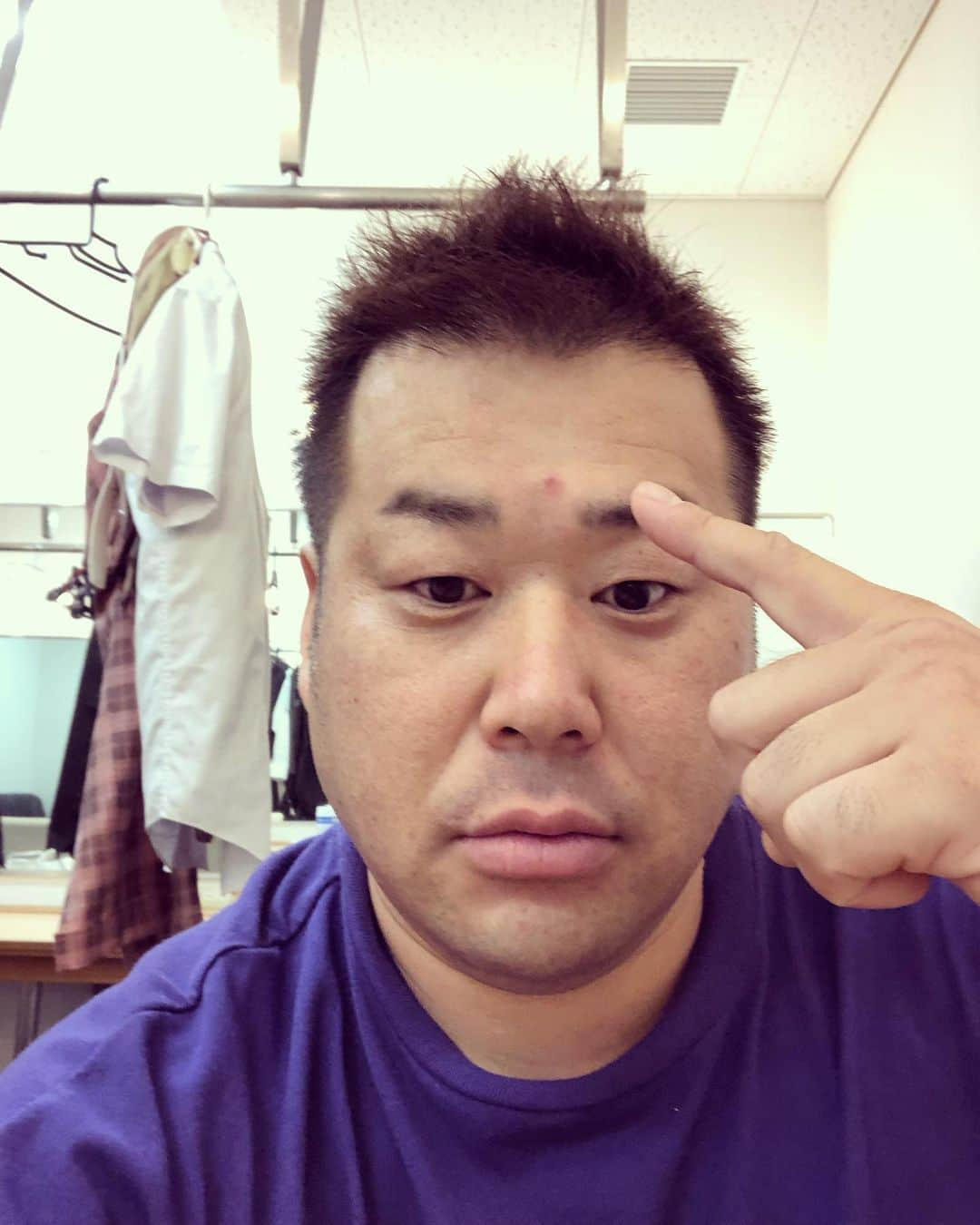 岩橋良昌さんのインスタグラム写真 - (岩橋良昌Instagram)「髪切って眉毛整えて白髪きってもらったで しかしおでこにインドの人かってくらいのニキビ 何日も消えへん 若いな ってことにしよ #髪伸びてきたぁ #ニキビ #千昌夫の位置 #古っ」9月2日 10時29分 - maeeeeen1084