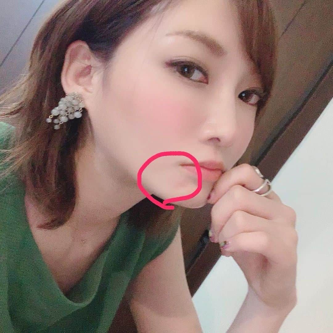 木下ゆうかさんのインスタグラム写真 - (木下ゆうかInstagram)「早く治って！」9月3日 16時01分 - yuka_kinoshita_0204