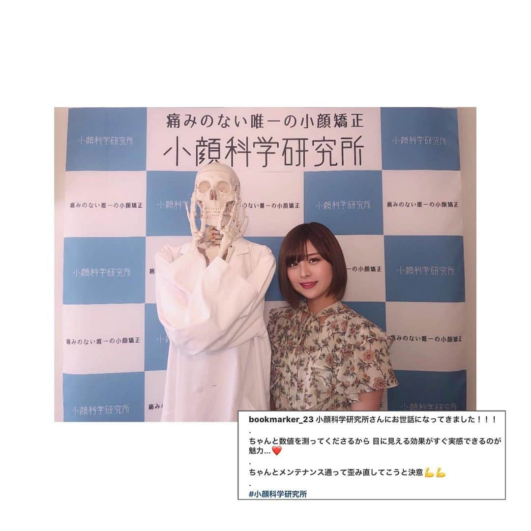 小顔科学研究所 さんのインスタグラム写真 - (小顔科学研究所 Instagram)「元AKB48の佐藤栞様が﻿ 初回小顔矯正を受けに来て下さいました✨﻿ ﻿ 硬いものを食べるのが好きということで﻿ 噛み癖からくるお顔の歪みと﻿ フェイスラインをスッキリさせたいとのことでしたが﻿ 施術後は歪みが整い﻿ エラなくなってる！﻿ と大変喜んでいただきました（≧∇≦）﻿ ﻿ お忙しい中ありがとうございました🌟﻿ またのご来店お待ちしております♪﻿ ﻿ 5周年感謝記念キャンペーン好評受付中🎵﻿ ﻿ ﻿ 🌟名古屋院 8/16.17.18限定 *人数無制限﻿ 【圧倒的小顔矯正 】﻿ 30%オフ 131,600円（税別）﻿ ﻿ ・*:..｡o○☼*ﾟ・*:..｡o○☼*ﾟ・*:..｡o○☼*ﾟ﻿ ﻿ 🌟大阪心斎橋院・福岡天神院限定 *1日1名様限定﻿ 【圧倒的小顔矯正 】﻿ 20%オフ 150,400円（税別）﻿ ﻿ ﻿ 🌟東京表参道院・大阪心斎橋院・福岡天神院 *1日1名様限定﻿ 【美容鍼2回コース】﻿ 50%オフ 15,000円(税別)﻿ ﻿ ﻿ ﻿ 【受付期間】2019年8月31日迄 ﻿ ﻿ この機会にぜひ、ご来院お待ちしております🙋‍♀️✨ ﻿ ﻿ また美容鍼も初回5,000円(税別)で受けて頂けます！﻿ 詳しくは2枚目の画像QRコードから﻿ お気軽にお問い合わせ下さいませ♪﻿ ﻿ ﻿ ﻿ ﻿ .﻿ .﻿ ┈┈┈┈┈┈┈┈┈┈┈┈┈┈┈┈┈┈﻿ ﻿ ﻿  #小顔 #小顔矯正 #骨盤矯正 #小顔科学研究所 #痛くない小顔矯正  #小顔効果 #小顔はつくれる #芸能人御用達 #美容 #整体 #美容整体  #顔の歪み #むくみ #たるみ  #表参道小顔矯正 #名古屋小顔矯正  #心斎橋小顔矯正 #福岡小顔矯正 #天神小顔矯正 #smallerface  #美容鍼 ﻿ #佐藤栞 #akb48」8月14日 14時23分 - kogaokagaku