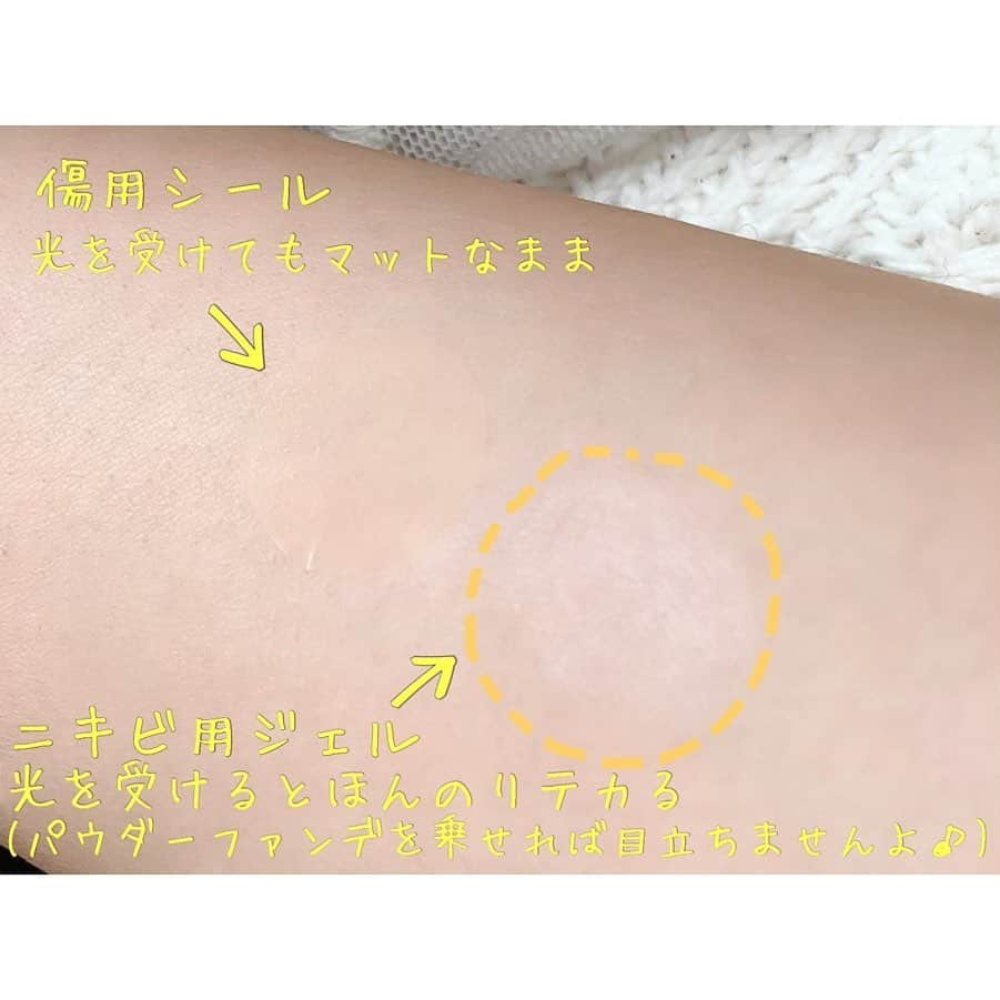 有村実樹さんのインスタグラム写真 - (有村実樹Instagram)「🏥﻿ 昨日のインスタライブでも質問がありましたので、﻿ ニキビができた時のレスキューコスメをご紹介します❣️﻿ ﻿ ﻿ ﻿ まず出来たニキビに対しては、﻿ ﻿ ☆クリニーク アクネクリアリングジェル ﻿ ﻿ こちらを、洗顔後にニキビが出来そうな部分や既に出来たニキビに指で薄く塗布。綿棒でポチッと乗せても◎﻿ 翌朝には一回り小さく、赤みも引いてくれます。﻿ 長引いて悪化するのを防げるので、いざという時に欠かせないアイテムです。﻿ ﻿ 乾くと少し膜を張るように肌表面に留まるので、その後のスキンケアは、塗った部分を避けるようにいつも通りの保湿をします。﻿ ニキビ部分の乾燥が気になる時には、洗顔後すぐではなく化粧水の後にポイント使いしてもOK。﻿ ﻿ 全顔にも使えますが、少しペリッとするので乾燥肌の人は部分使いがオススメです。﻿ ジェルを塗布した上から保湿も出来ますが、水分や油分に加え、手の圧がかかりすぎると塗ったジェルが剥がれてしまうので、手のひらで優しく触る程度のスキンケアにしましょう。﻿ ﻿ ちなみに、メイク前にも使えます👍﻿ 薄く膜を張ってくれるので、メイク前に綿棒でポイント使いすると、日中もニキビを鎮静し続けて悪化を防いでくれます。﻿ 水分がつくと少しヌルッとして落ちてきてしまったり、指でこすると消しかすのように剥がれることがあるので、上からメイクをするときにはリキッドではなく、パウダーファンデをポンポン付けするといいですよ。﻿ ﻿ 光を受けるとテカリが出ますがパウダーファンデを使えばテカリ感が消えるので問題ありません♪﻿ ﻿ ﻿ ﻿ ﻿ 続いて、﻿ ﻿ ☆はるコスメ﻿ ﻿ シールなのでクリニークのジェルよりも存在感はありますが、光を受けてもマットで目立ちません。﻿ しっかり乾いた肌に貼らないとよれて剥がれてしまうので、張る時が一番大切です。﻿ クリニークのジェルと同じように、上からメイクができます。﻿ やはりパウダーファンデが好相性✨﻿ 傷用シールということでニキビを鎮静させる成分はありませんが、UVカットしてくれるので、ニキビ跡をシミにしたくない時や虫刺されなどの傷にも使えます。﻿ 口周りは目周りなど皮膚がよく動く部分だとシワになって剥がれやすいので、おでこや頬などの広い部分に使うといいかもしれません。﻿ ﻿ ﻿ ﻿ ﻿ 🌼幅広く使いたいときのお守り<はるコスメ>﻿ ﻿ 🌼ニキビをすぐに鎮静させたいときのお守り<アクネクリアリングジェル>﻿ ﻿ ﻿ 持っておくと安心なコスメですよ💕﻿ ﻿ ﻿ ニキビは出来たとしてもちゃんとケアすれば治りがずいぶんと早くなりますので、あまり心配せず、適切にケアしましょう。﻿ ﻿ ﻿ ﻿ ニキビが出来たとき潰れた時の対処法も以前の記事にありますので、あわせてご覧くださいね😊﻿ ﻿ ﻿ こちら﻿ #miki_beauty_movie_ニキビ ﻿ ﻿ ﻿ ﻿ ﻿ #beauty #miki_cosmetics_list #ニキビ #ニキビ痕 #吹き出物 #大人ニキビ #ニキビパッチ #はるコスメ #クリニーク #アクネクリアリングジェル #傷 #肌荒れ #美肌 #美容」8月15日 13時43分 - arimura_miki