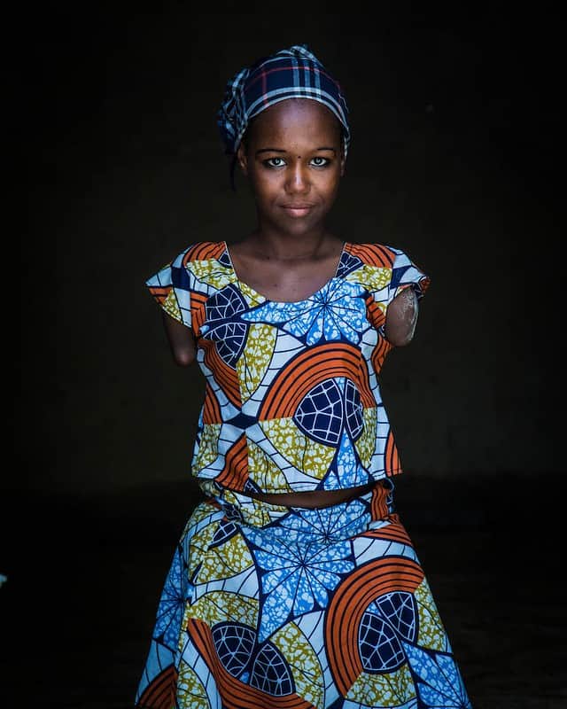 unicefさんのインスタグラム写真 - (unicefInstagram)「"I would like to become a lawyer to defend people’s rights. I was born without arms and legs, but I want to achieve my goal in life.” Aicha, 12, Nigerian refugee in Niger. . 📸 @Vtremeau, presented by @un_ocha. #AChildIsAChild」8月15日 21時55分 - unicef