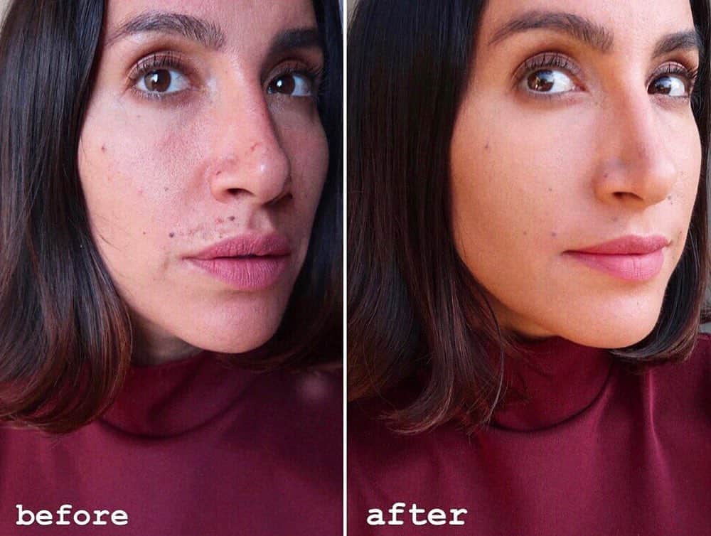 JEN ATKINさんのインスタグラム写真 - (JEN ATKINInstagram)「What melasma moustache? From 🤵🏽 to 👧🏻 this @diormakeup Forever foundation just covered up all of the sun damage i’ve done this summer. (i’m wearing shade 3 Warm Olive) Thx @mimberly @fannybourdettedonon for existing!! #diorpartner #ILoveMySkinInDior」8月16日 7時03分 - jenatkinhair