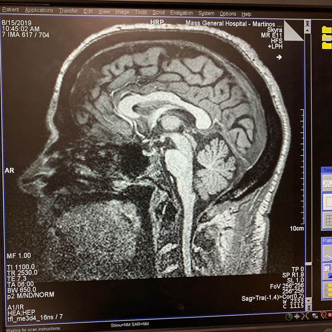 Robert Clarkさんのインスタグラム写真 - (Robert ClarkInstagram)「I always wondered what it looked like inside my head here’s a fMRI (functional magnetic resonance imaging) of my #brain for a story on #pain @natgeo #OnAssignment #Harvard」8月16日 0時59分 - robertclarkphoto